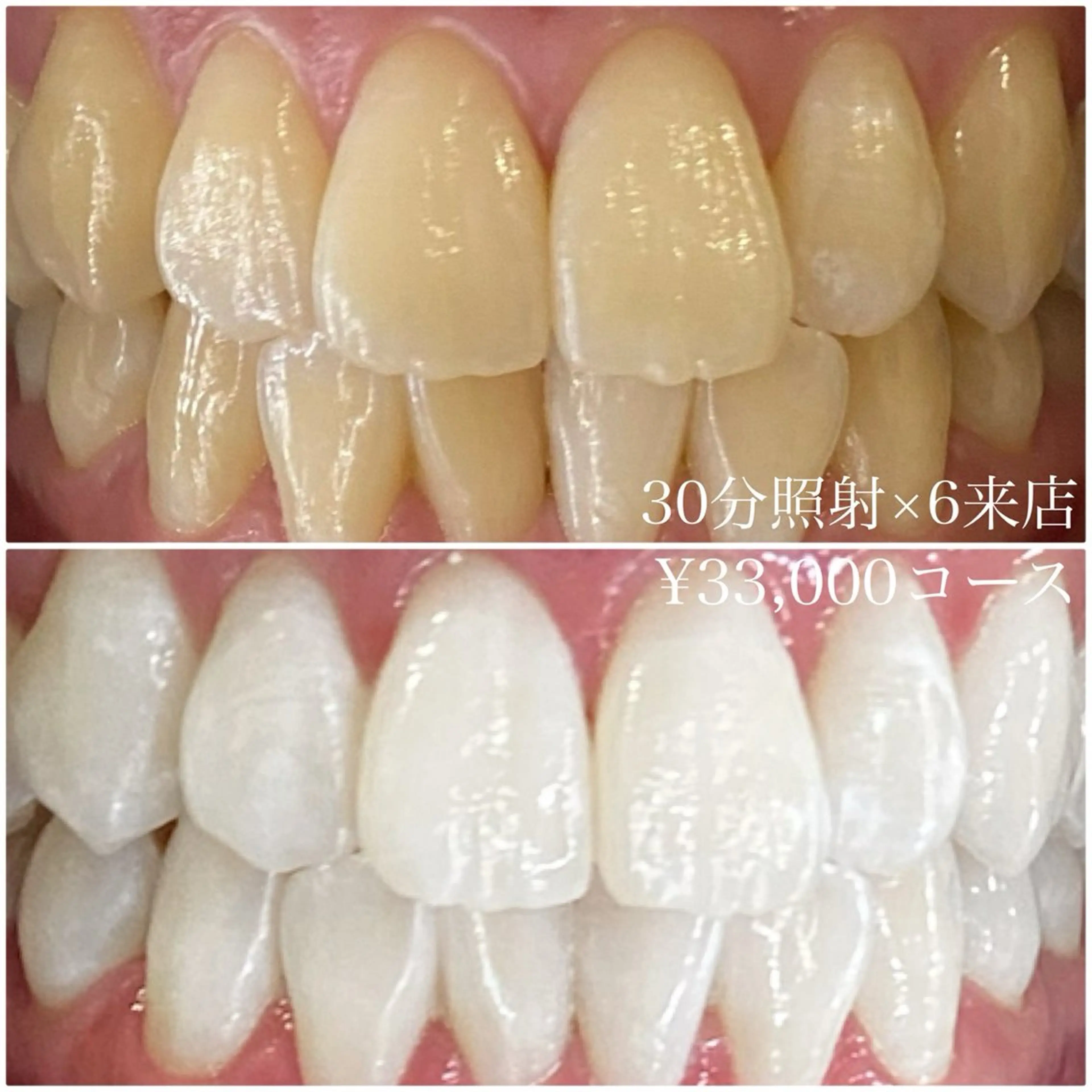 その他 PLATINUM Beauty 横浜店所属・ホワイトニングルーム 横浜店のその他イメージ