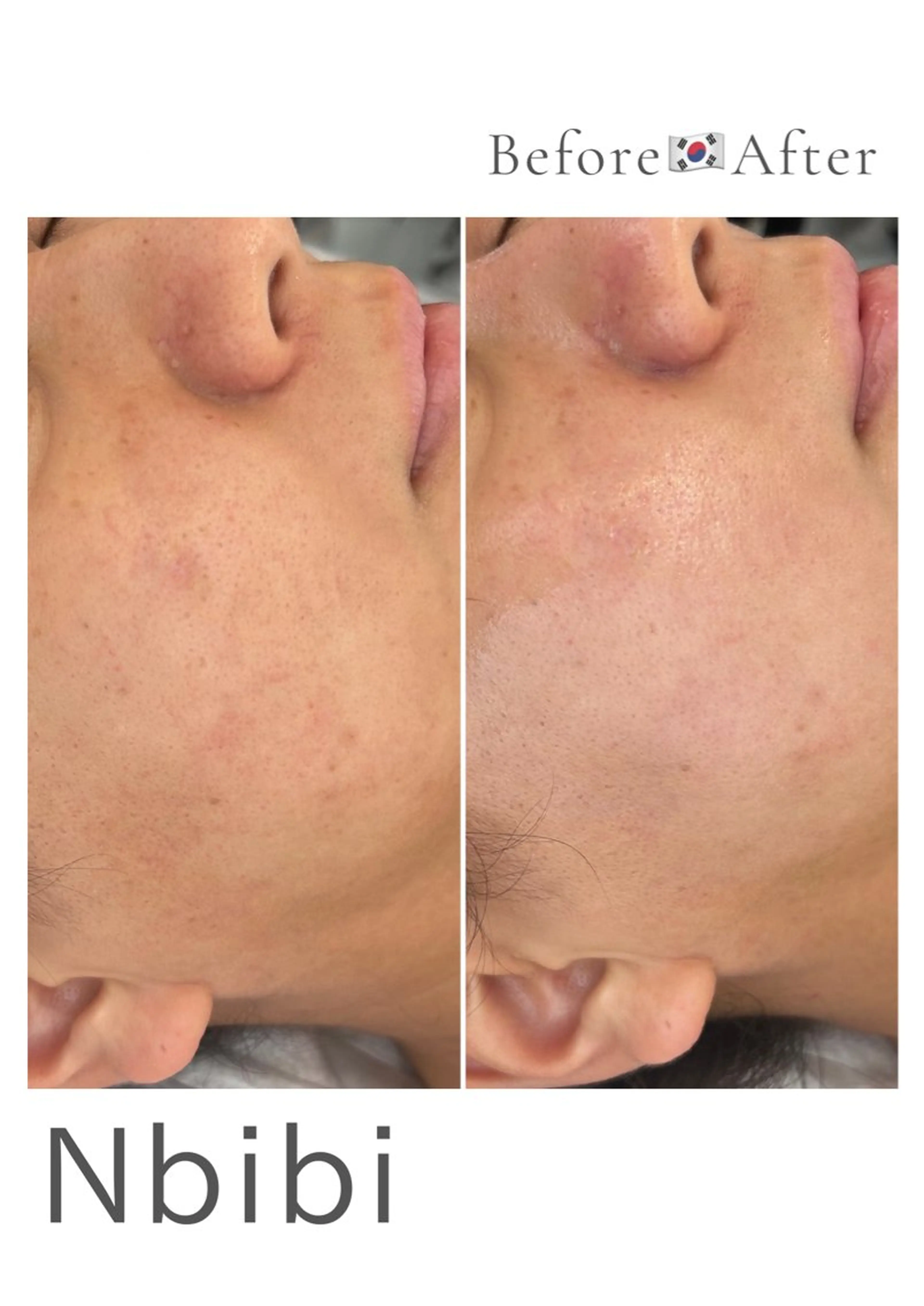 韓国🇰🇷価格 サロン_Nbibiのエステ・リラクイメージ