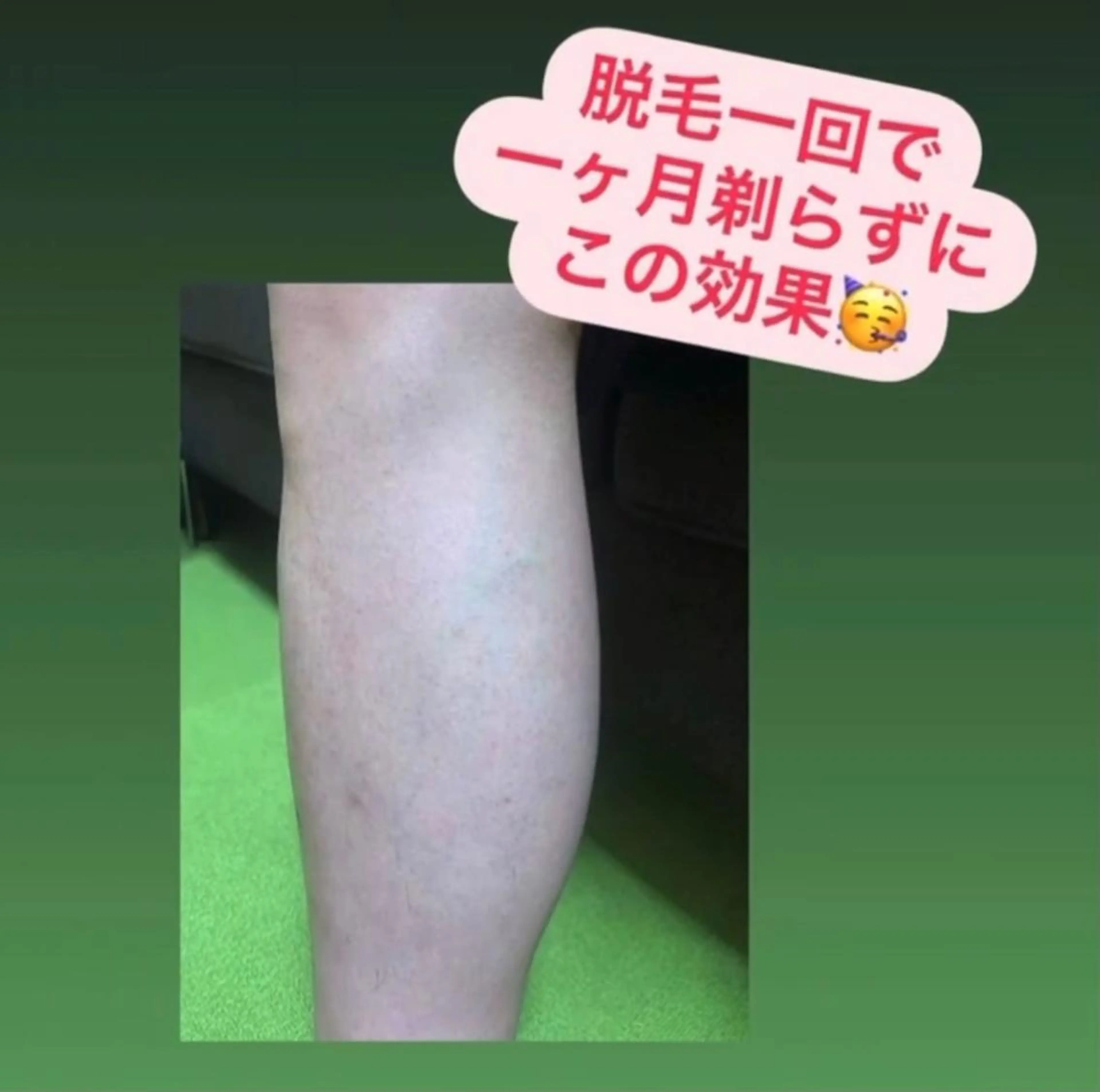 メンズ 大阪脱毛|ちぇるま| 眉毛Wax|美肌管理のエステ・リラクイメージ