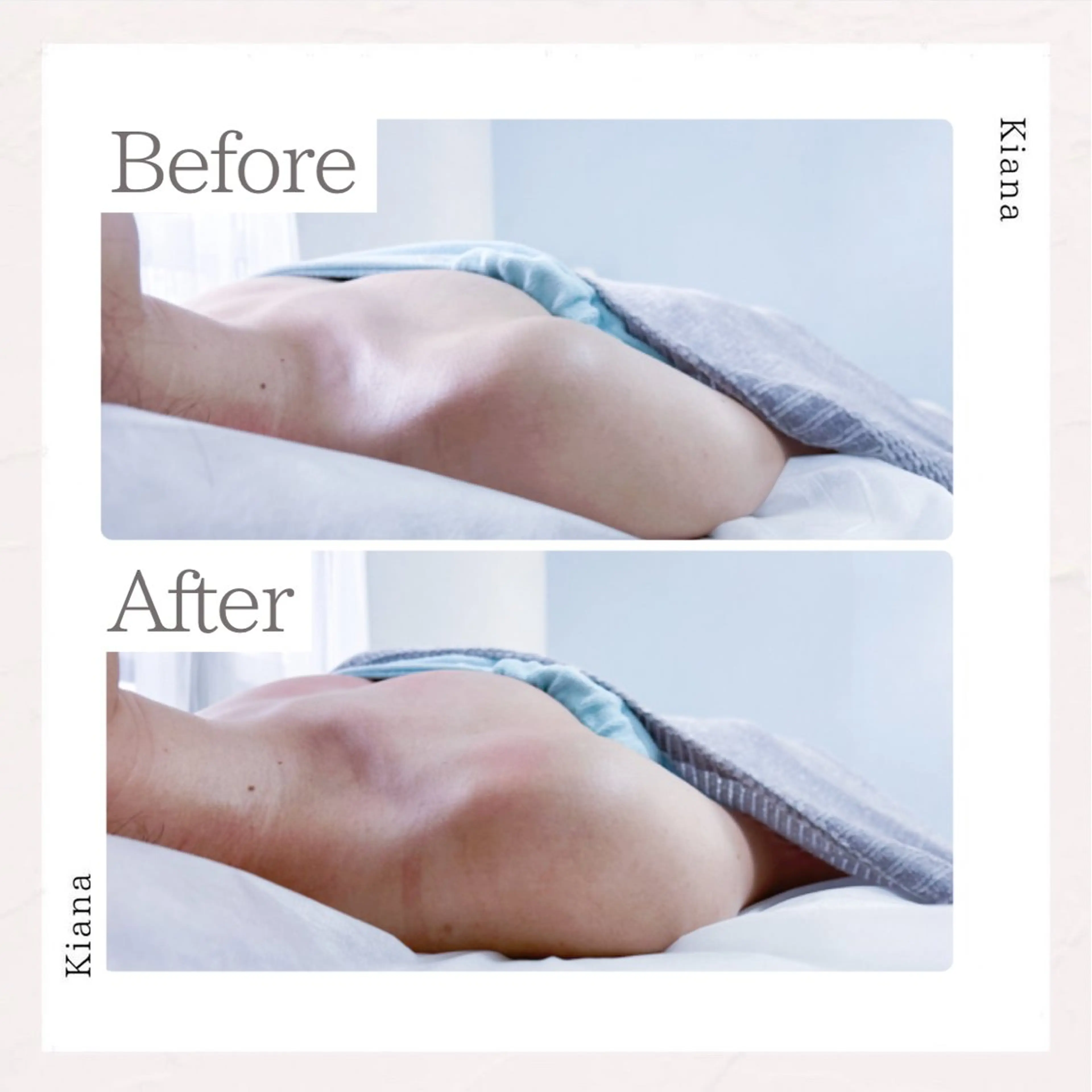 エステ リラク バスト専門Kiana 風のエステ・リラクイメージ