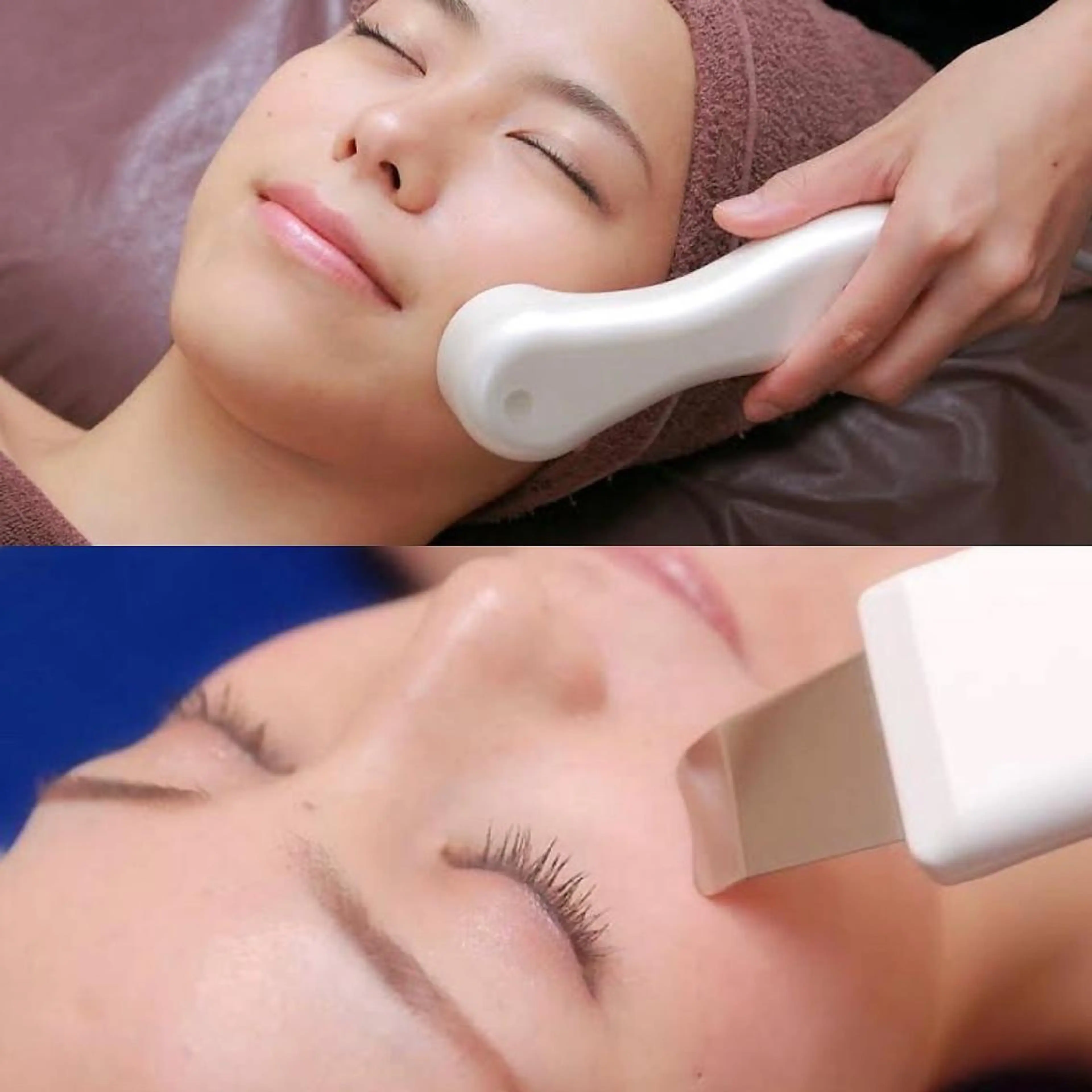 【毛穴洗浄×エレクトロポレーション】徹底毛穴リメイクコース8,800円→6,600円の写真