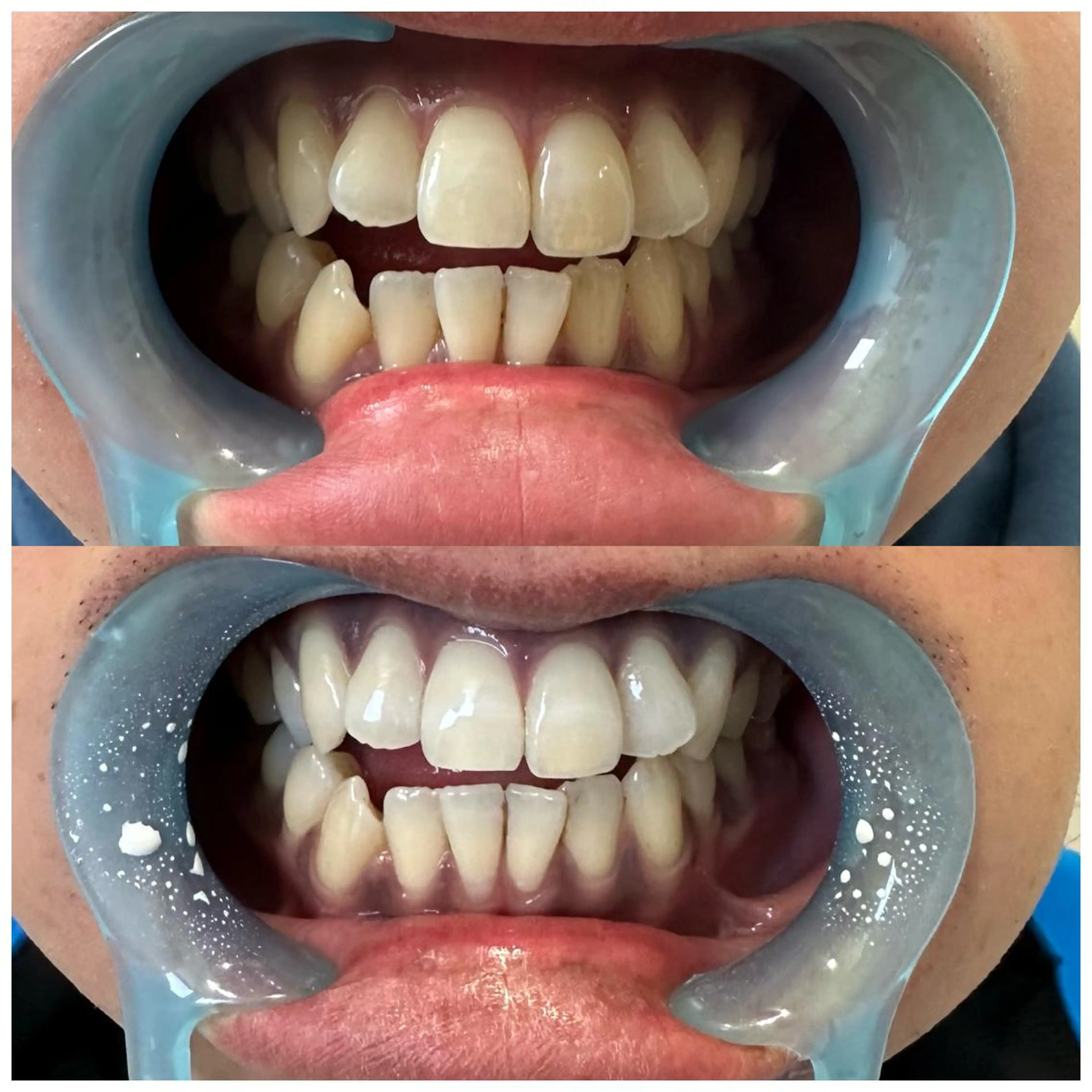 メンズ その他 REAL beauty salon所属・【脱毛専門】 REALbeautyのエステ・リラクイメージ