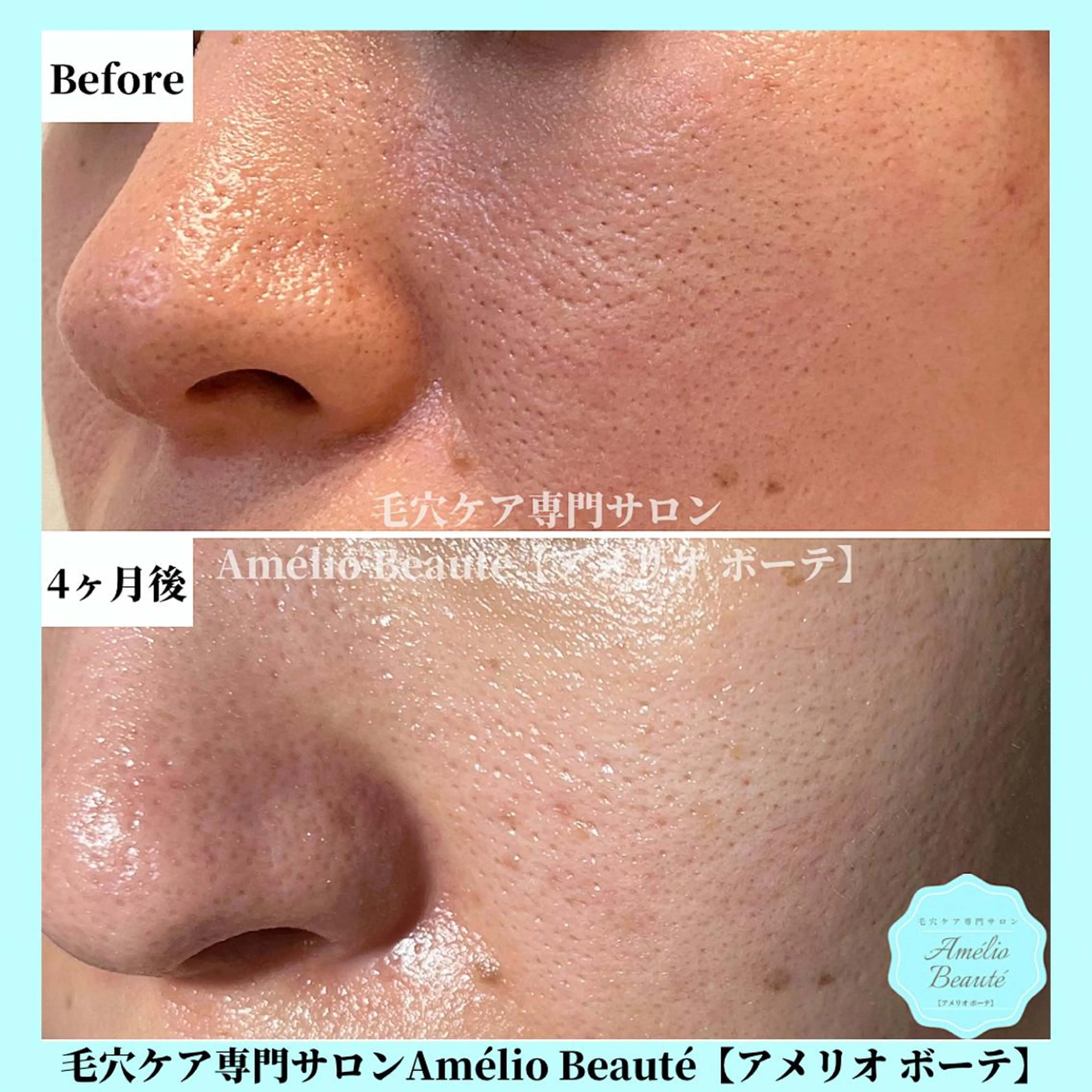 毛穴ケア専門サロン Amélio Beauté所属・毛穴ケア専門サロン アメリオボーテのその他イメージ