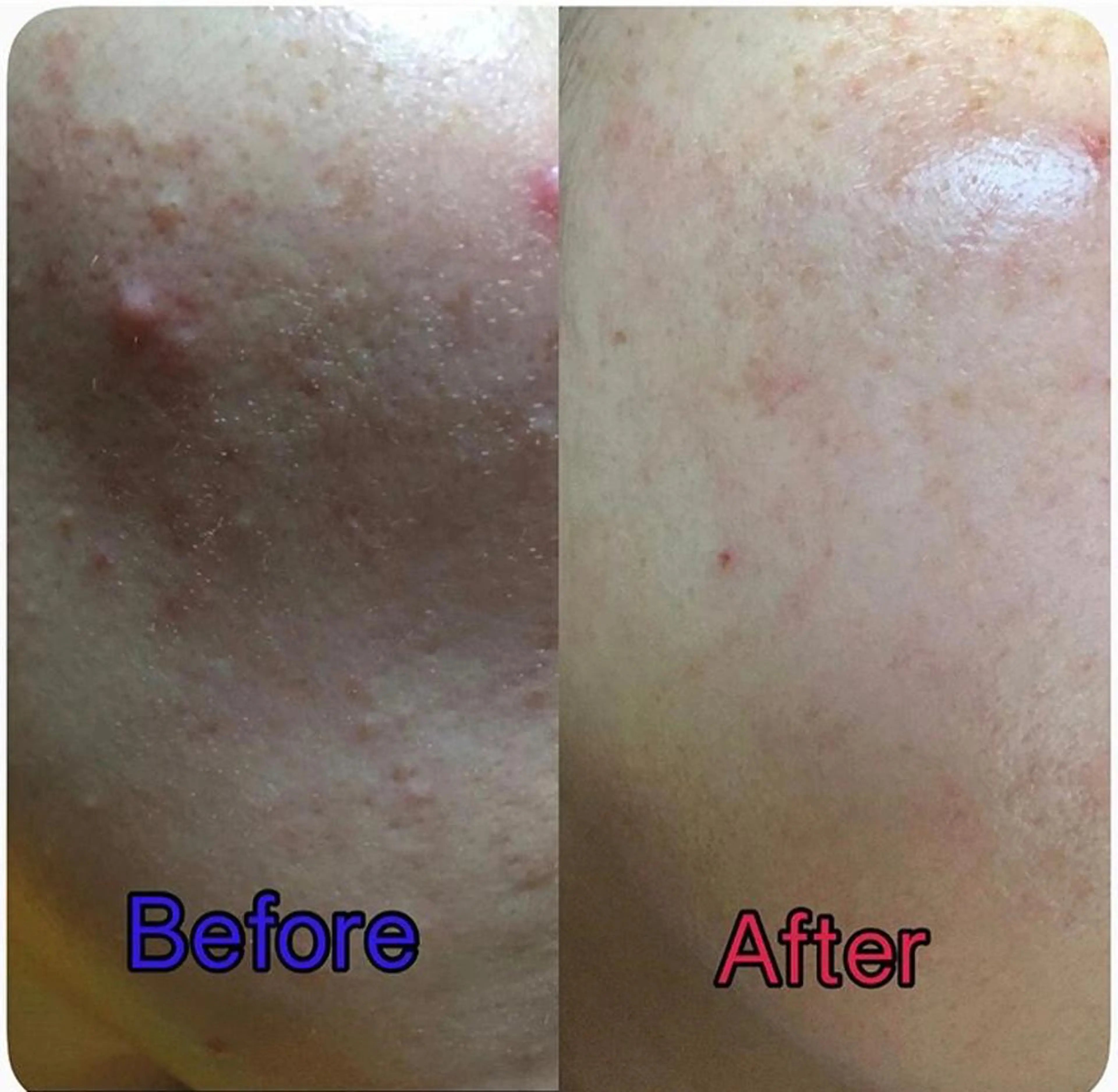 🏳️‍🌈 CHIYAKAのエステ・リラクイメージ