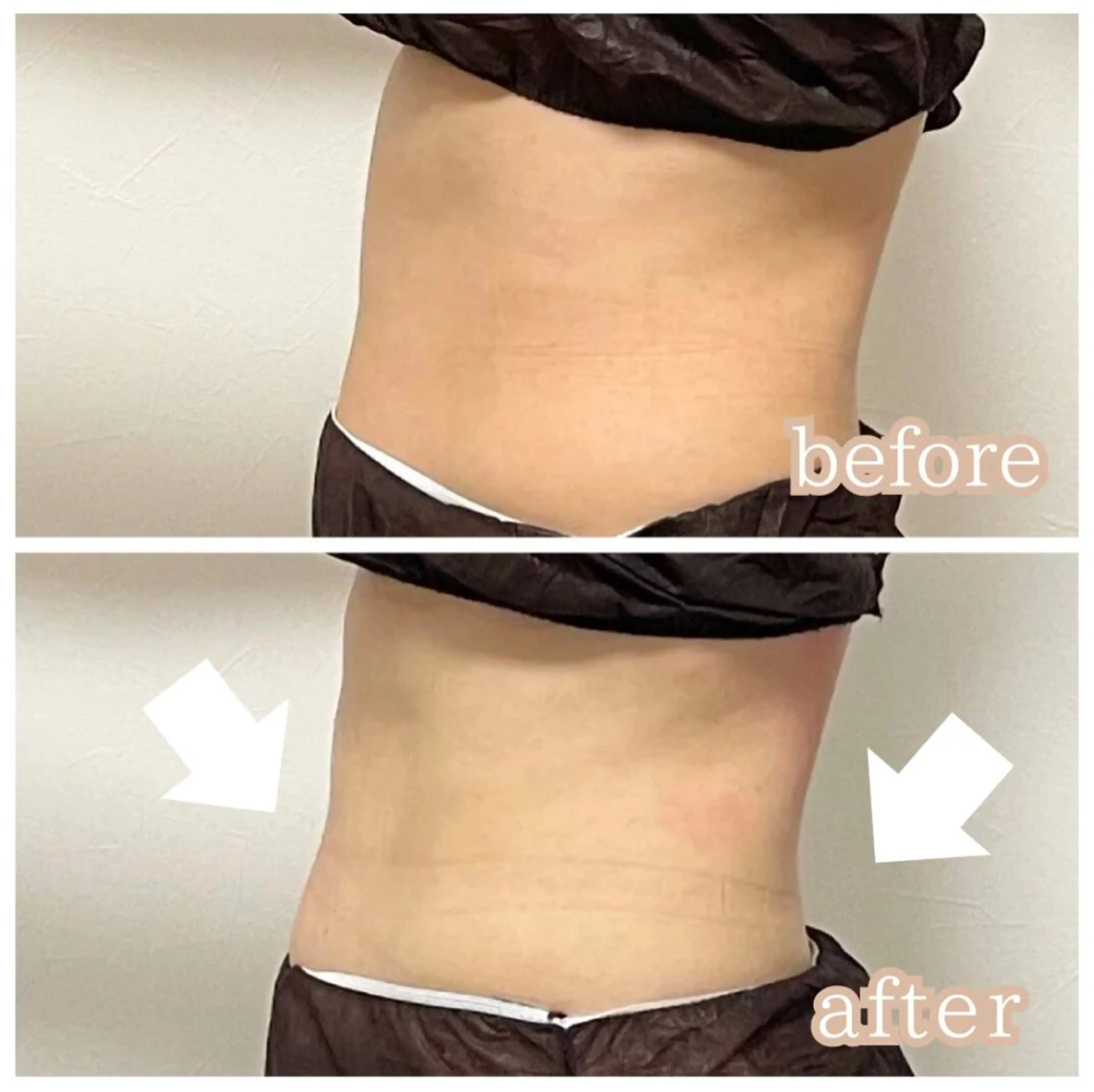 ハーブ蒸し小顔矯正サロンLino所属・ハーブ蒸し小顔矯正 サロンLinoのエステ・リラクイメージ