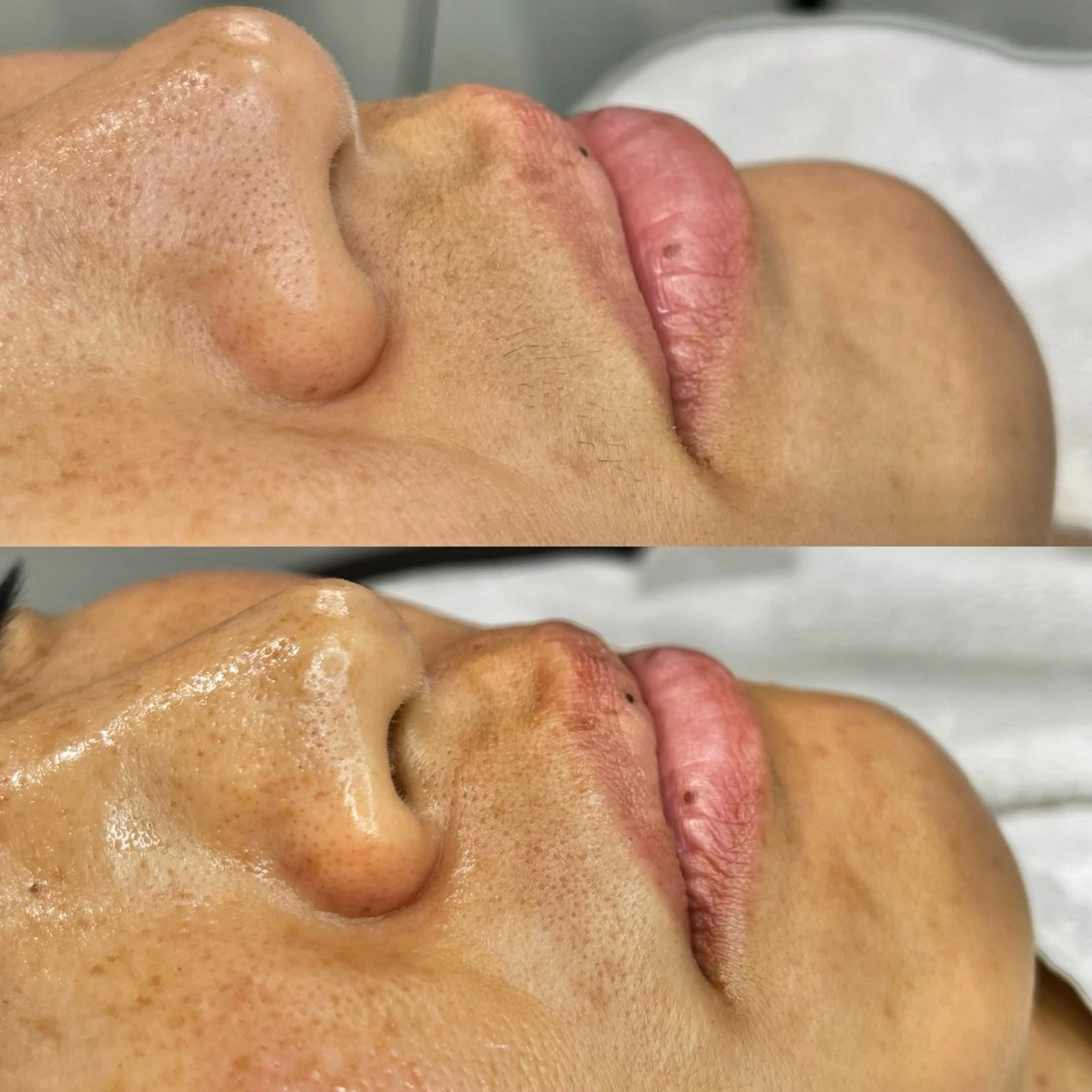 アイブロウ 眉毛ワックス脱毛 ワックス脱毛 眉カット その他(アイブロウ) 垢抜け眉プロデュース 🪄✨madokaの眉毛・アイブロウイメージ