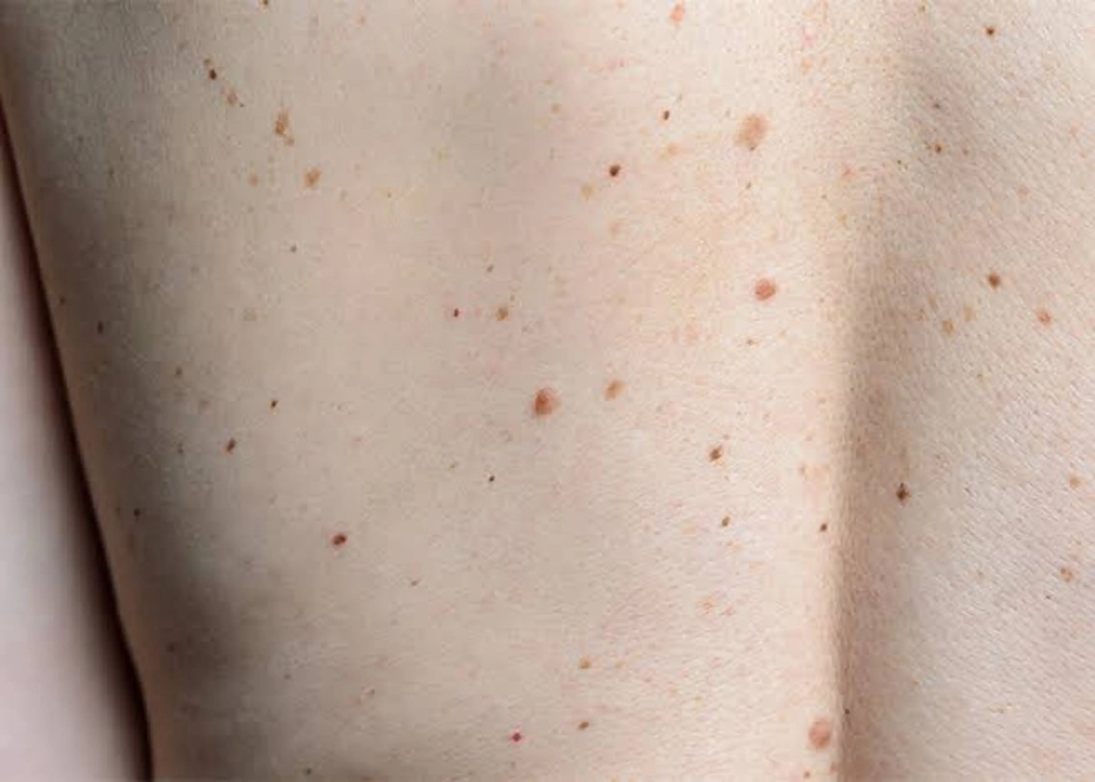 ハーブピーリング専門 muro.のエステ・リラクイメージ