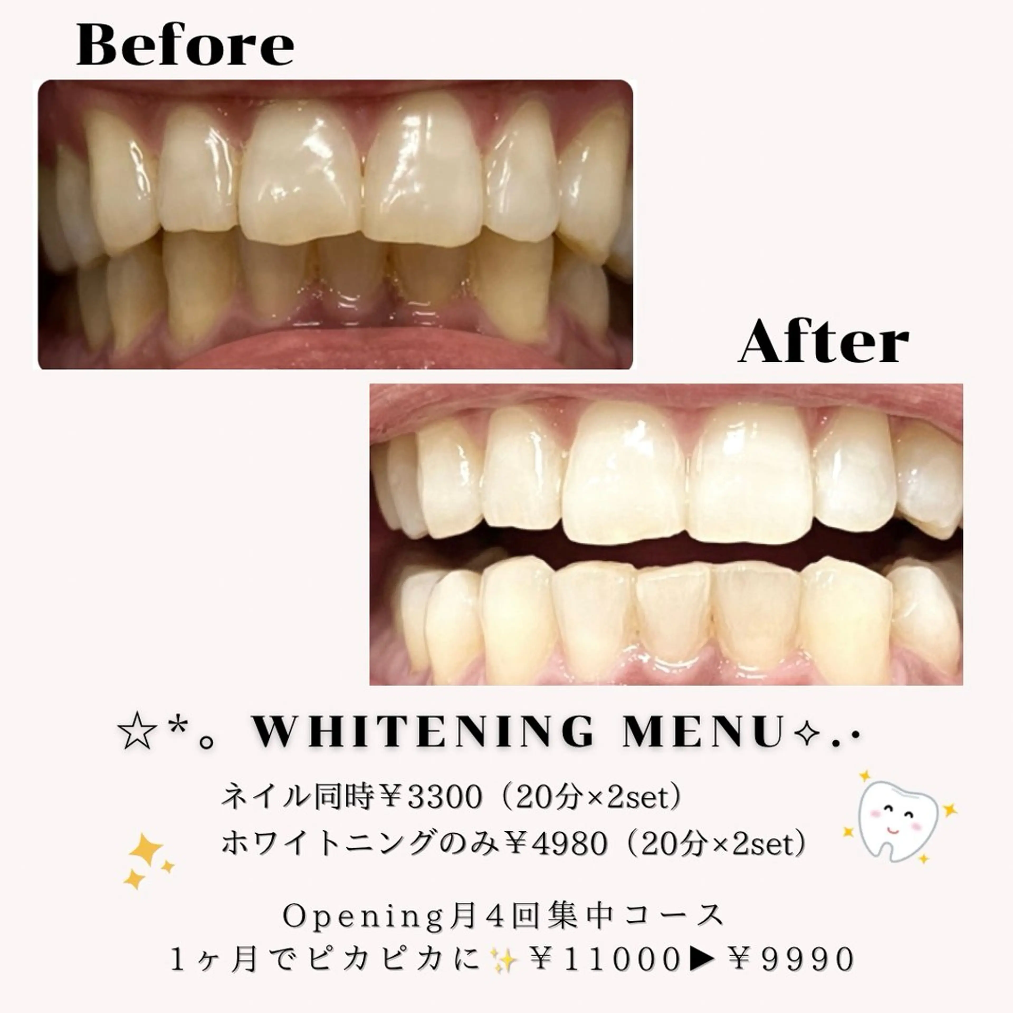 EmaNail＋KIHAKUYA東大阪長瀬店所属・EmaNail YUIのネイルデザイン