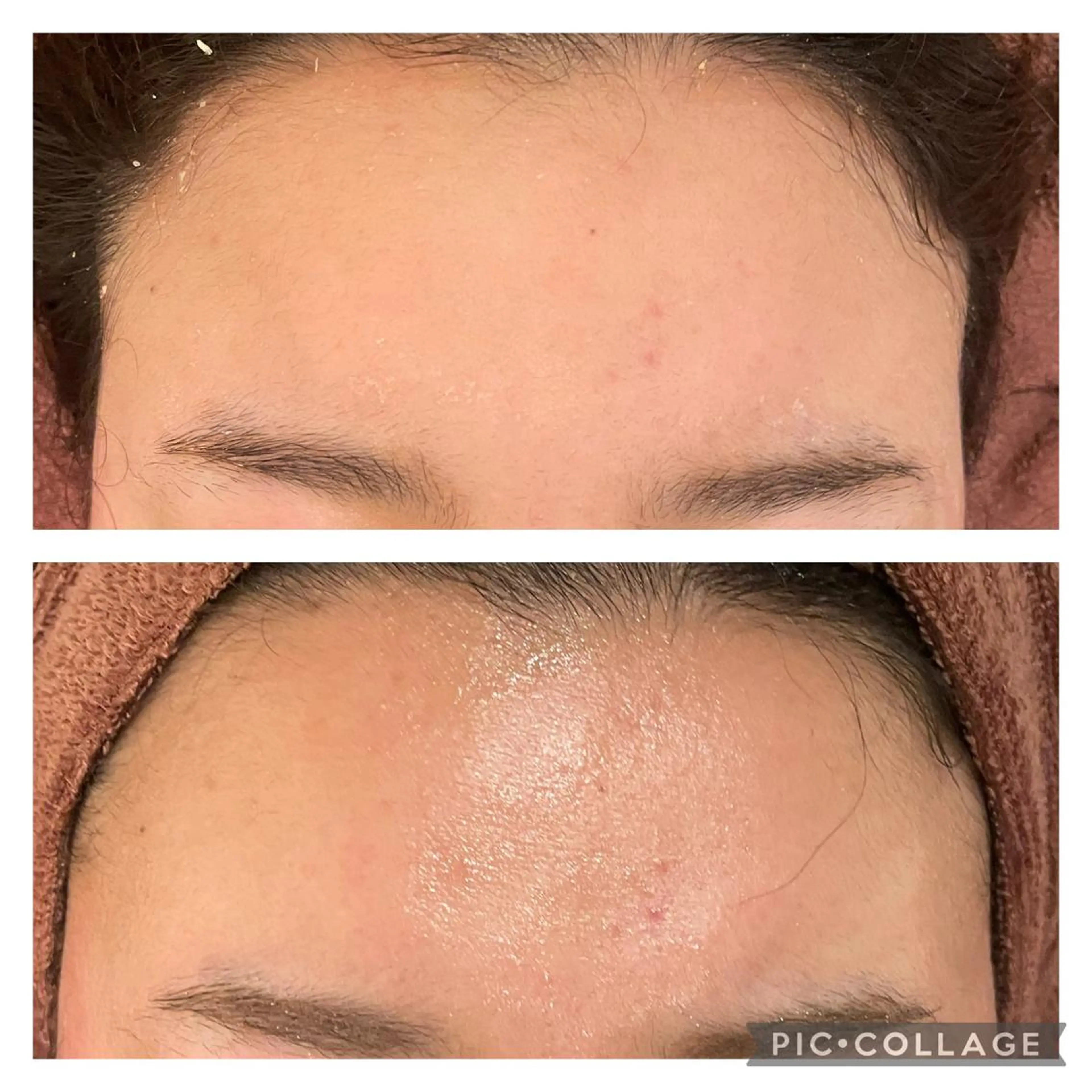 セミロング カラー パーマ ヘアアレンジ メンズ キッズ ネイル マツエク・マツパ アイブロウ エステ リラク ニキビ特化型エステ 🍓最短で肌質改善のエステ・リラクイメージ