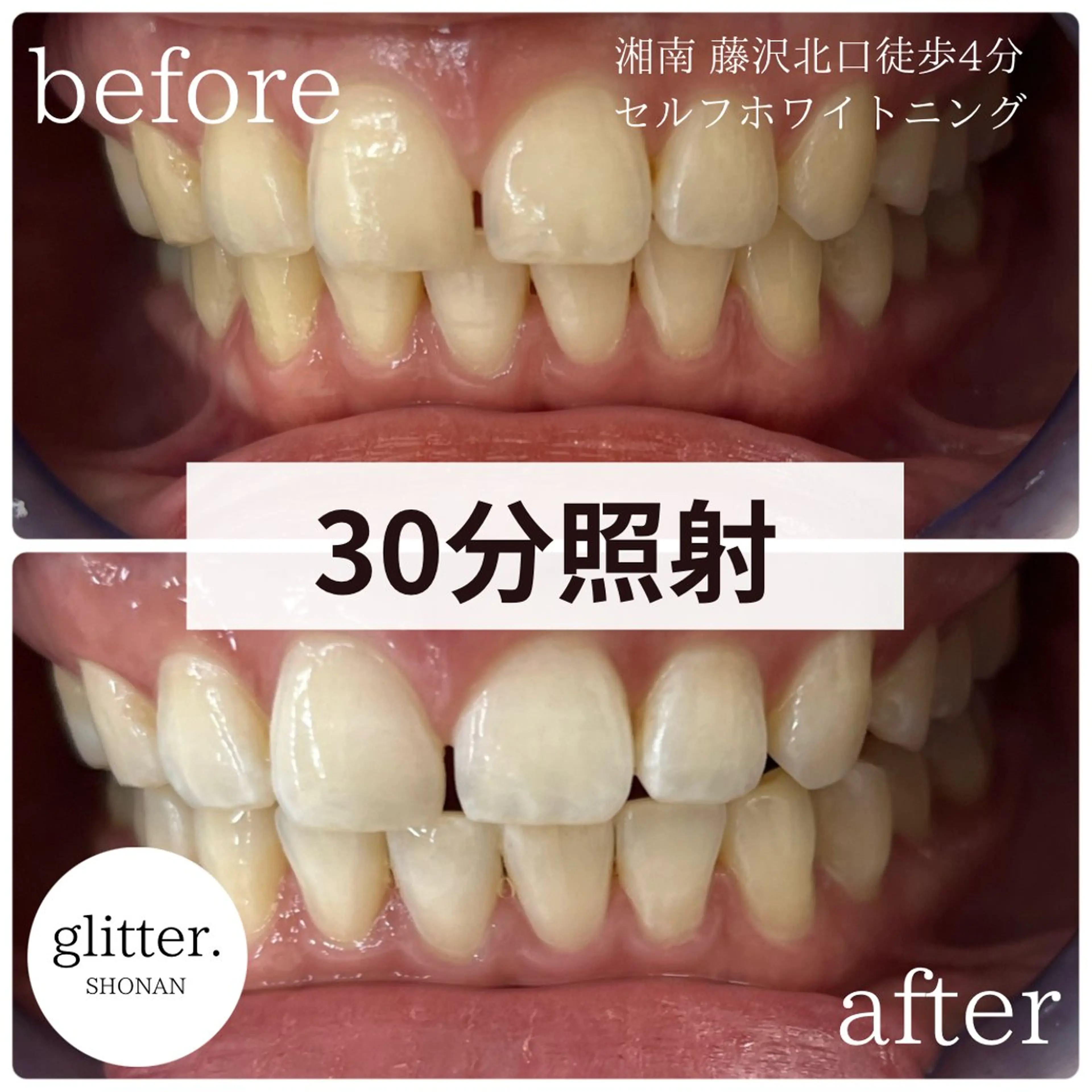 glitter.SHONAN所属・佐久間 茉弥のエステ・リラクイメージ