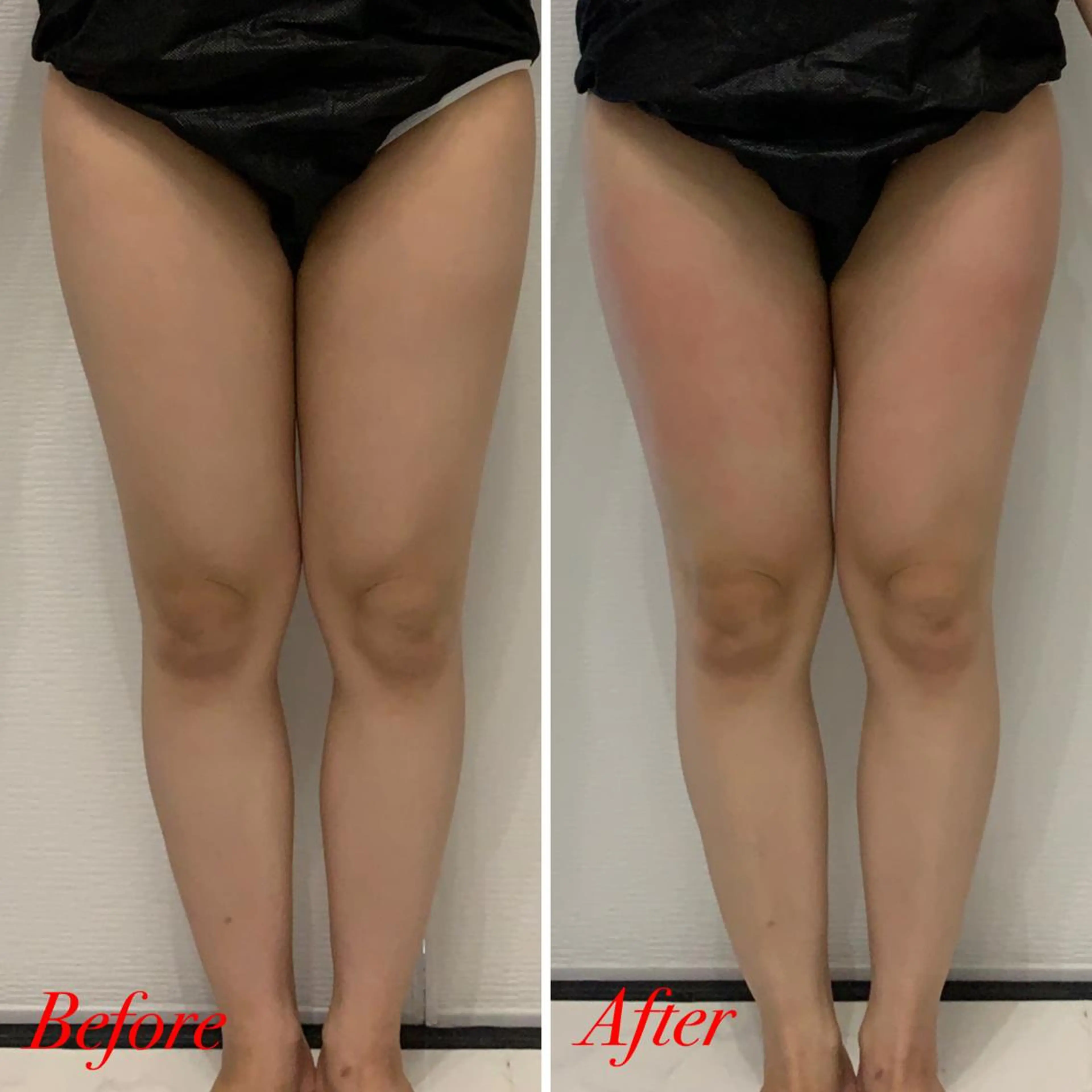 エステ リラク R.M所属・プライベートサロン R.Mのエステ・リラクイメージ