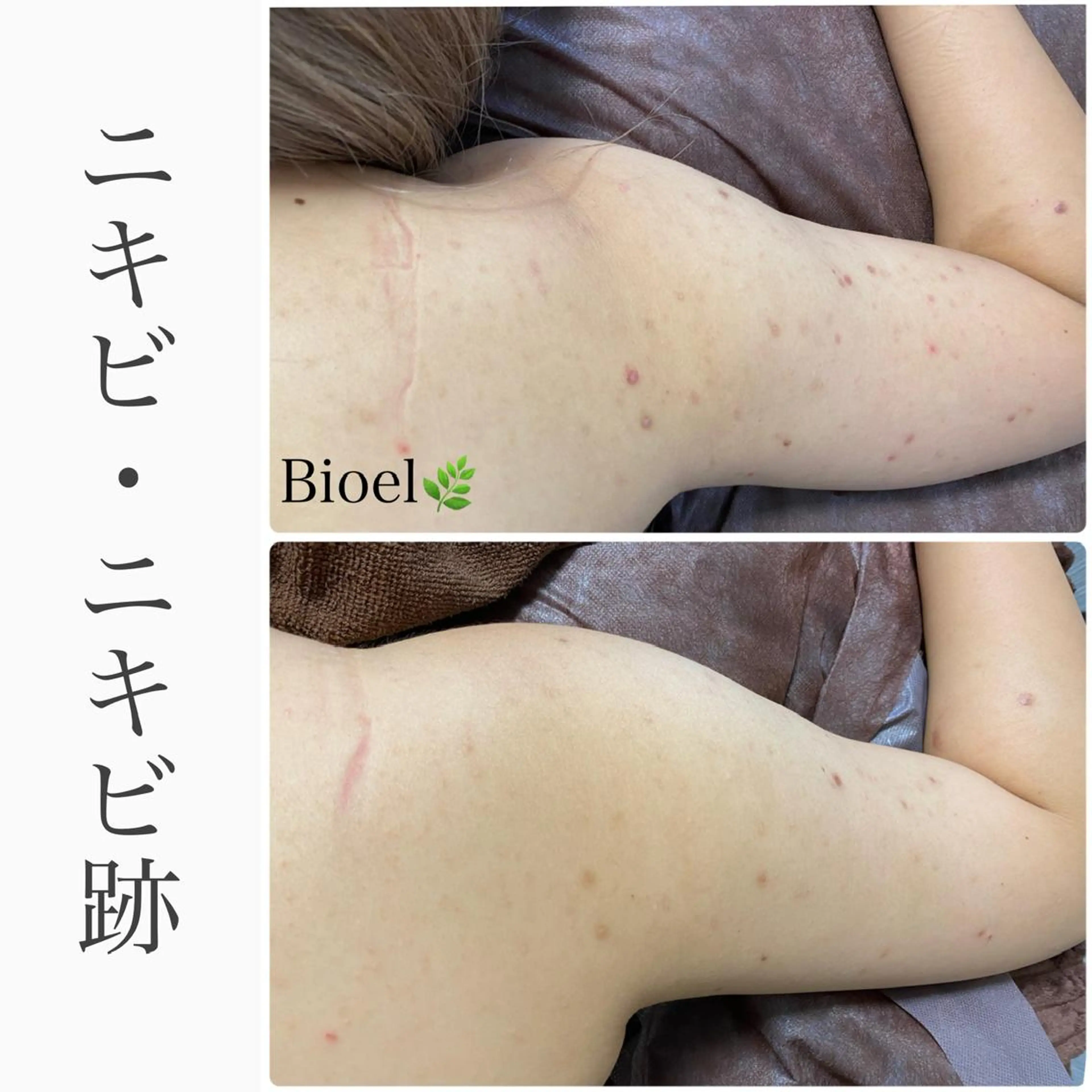 エステ BeSkin藤沢店所属・ニキビ/肌質改善 BeSkin 藤沢店のエステ・リラクイメージ