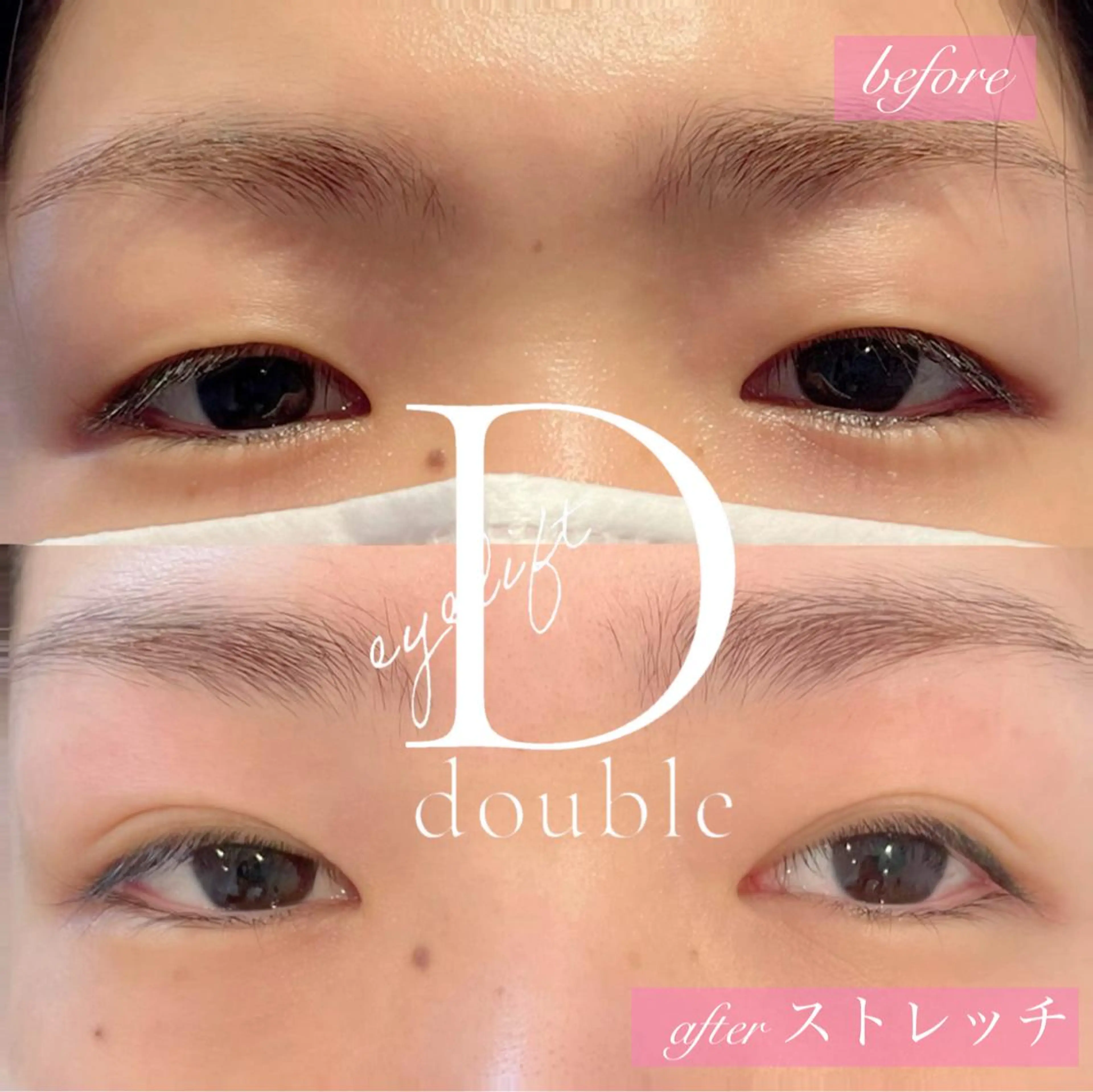 マツエク・マツパ eyelist kのマツエク・マツパデザイン