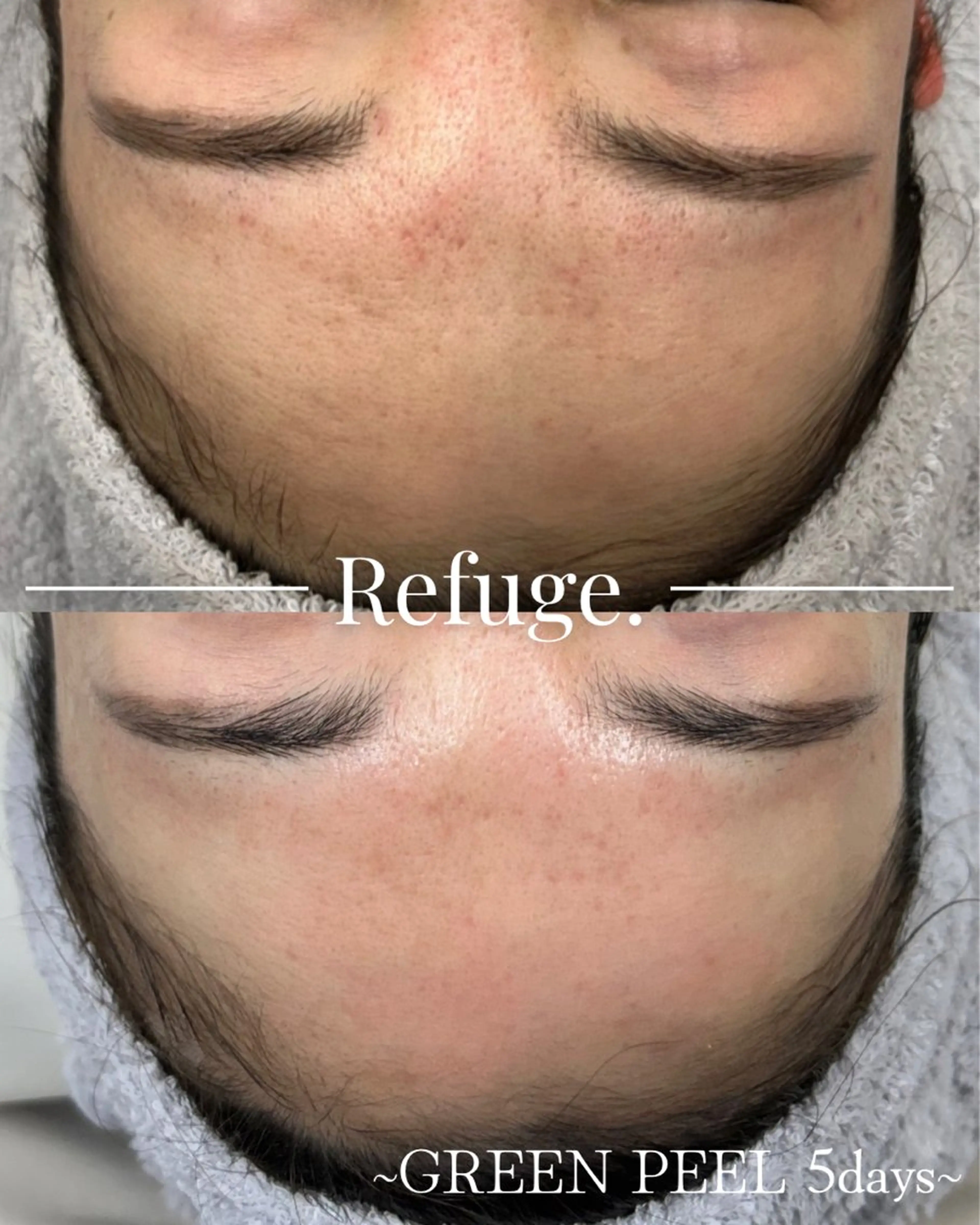 グリーンピール専門サロン Refuge.所属・Refuge. （リフュージュ）のエステ・リラクイメージ