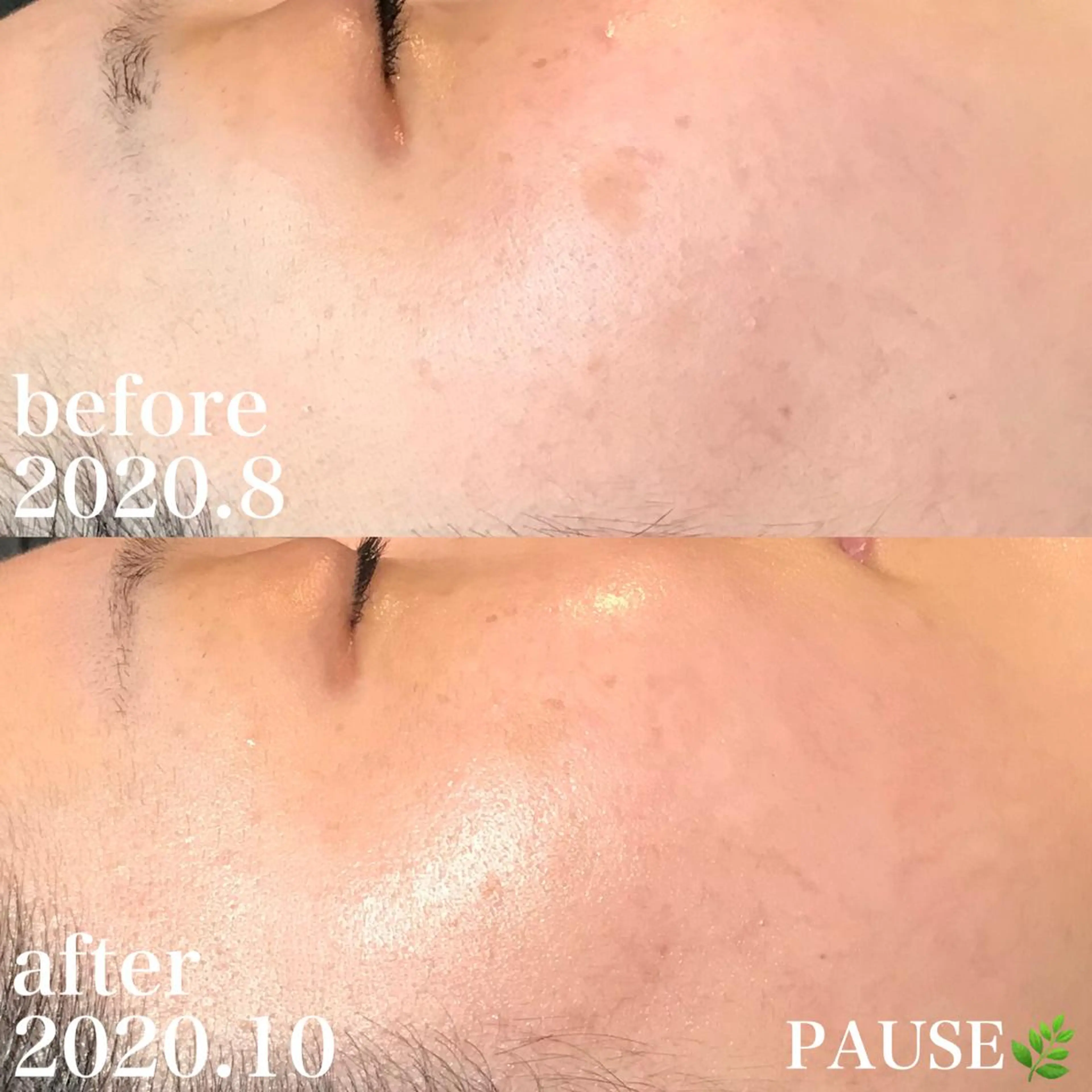 エステ 浜野 恵美のエステ・リラクイメージ