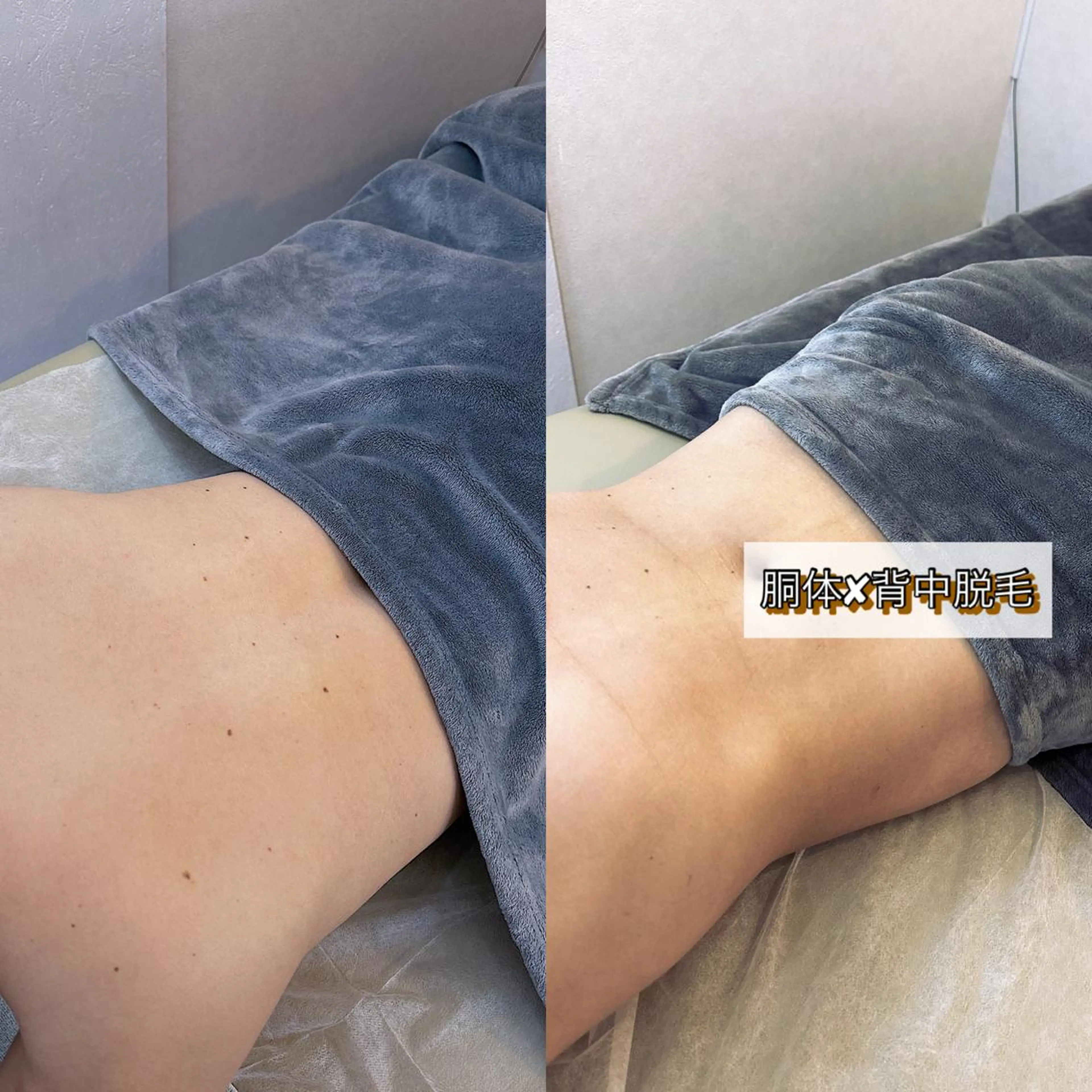 うなじ脱毛/美肌脱毛 LABELのエステ・リラクイメージ