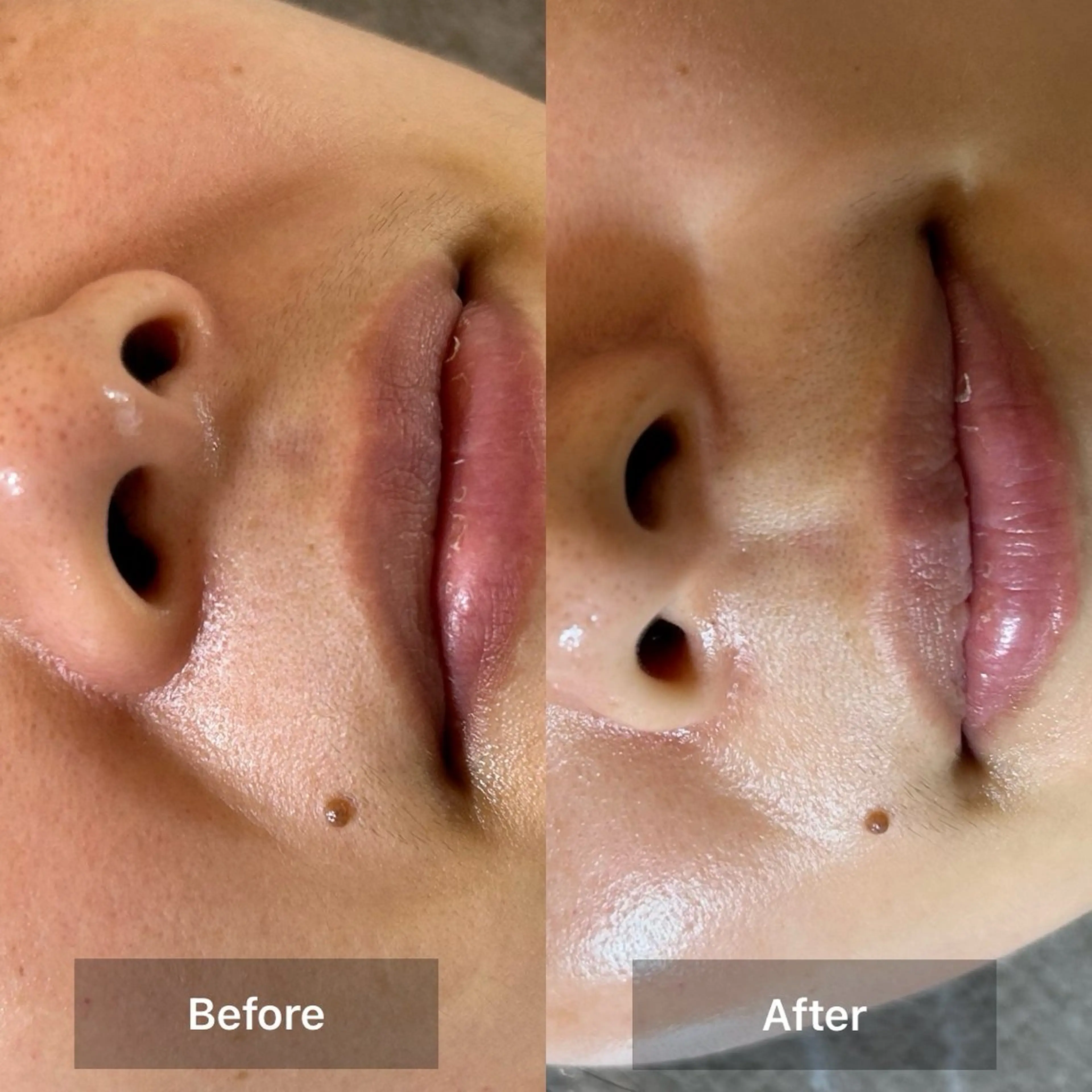 エステ リラク 目元・まつパ・美肌フ ェイシャル谷町四丁目のマツエク・マツパデザイン