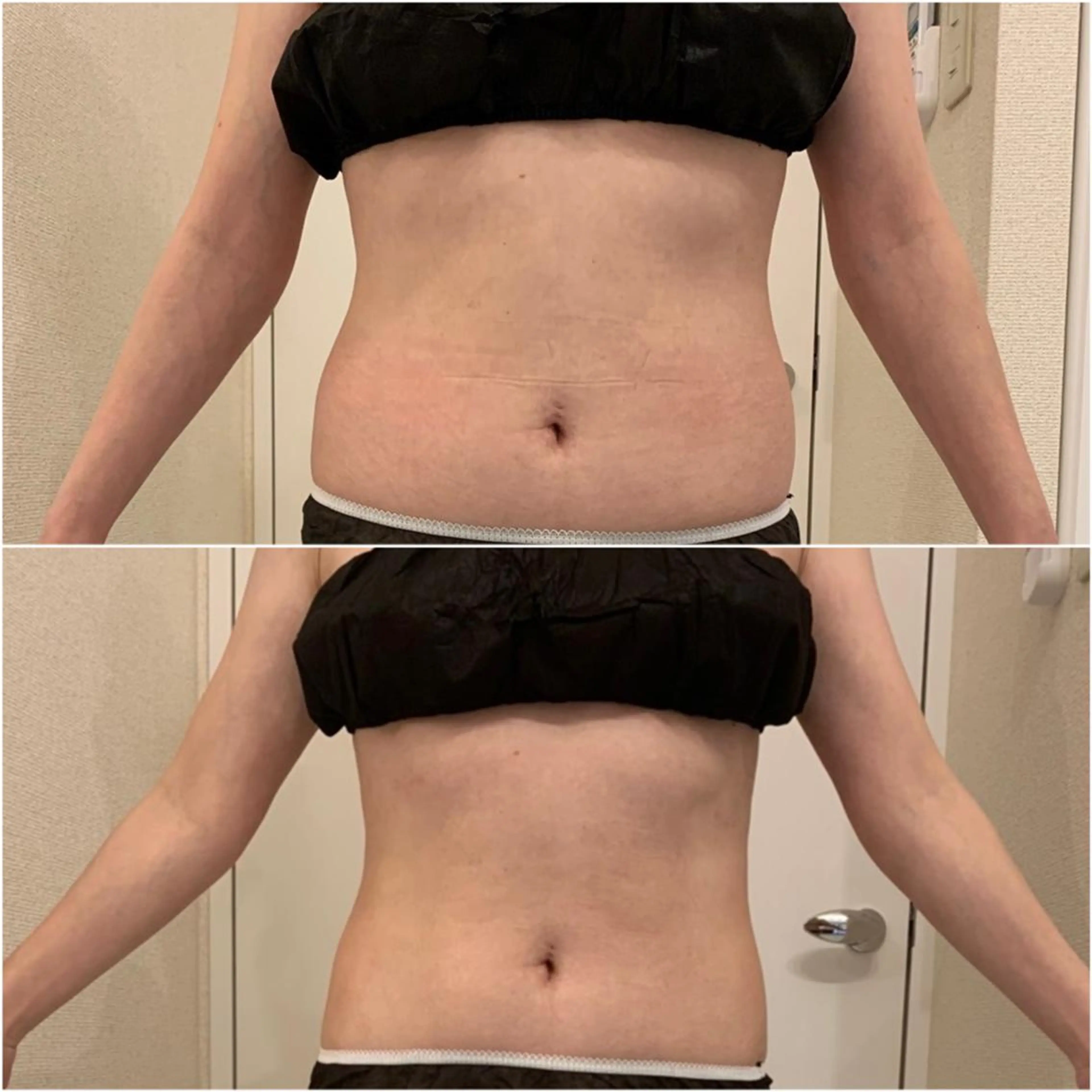 ✨美肌水光✨ アトリエリュバンのエステ・リラクイメージ