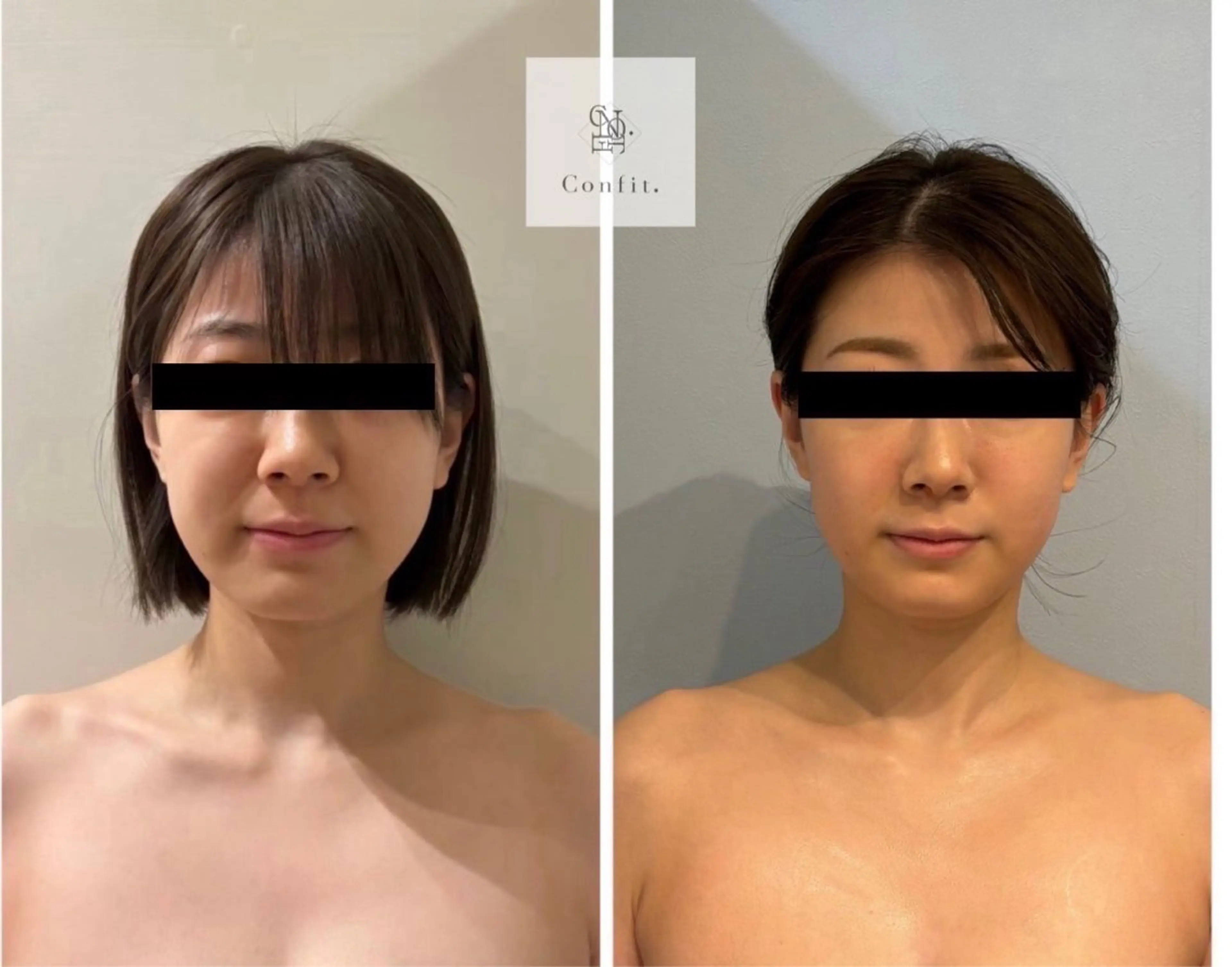 エステ 小顔/たるみ/黒ずみ除去専門サロン/SONA 大和西大寺店所属・【小顔痩身専門看護師 サロンSONA】のエステ・リラクイメージ