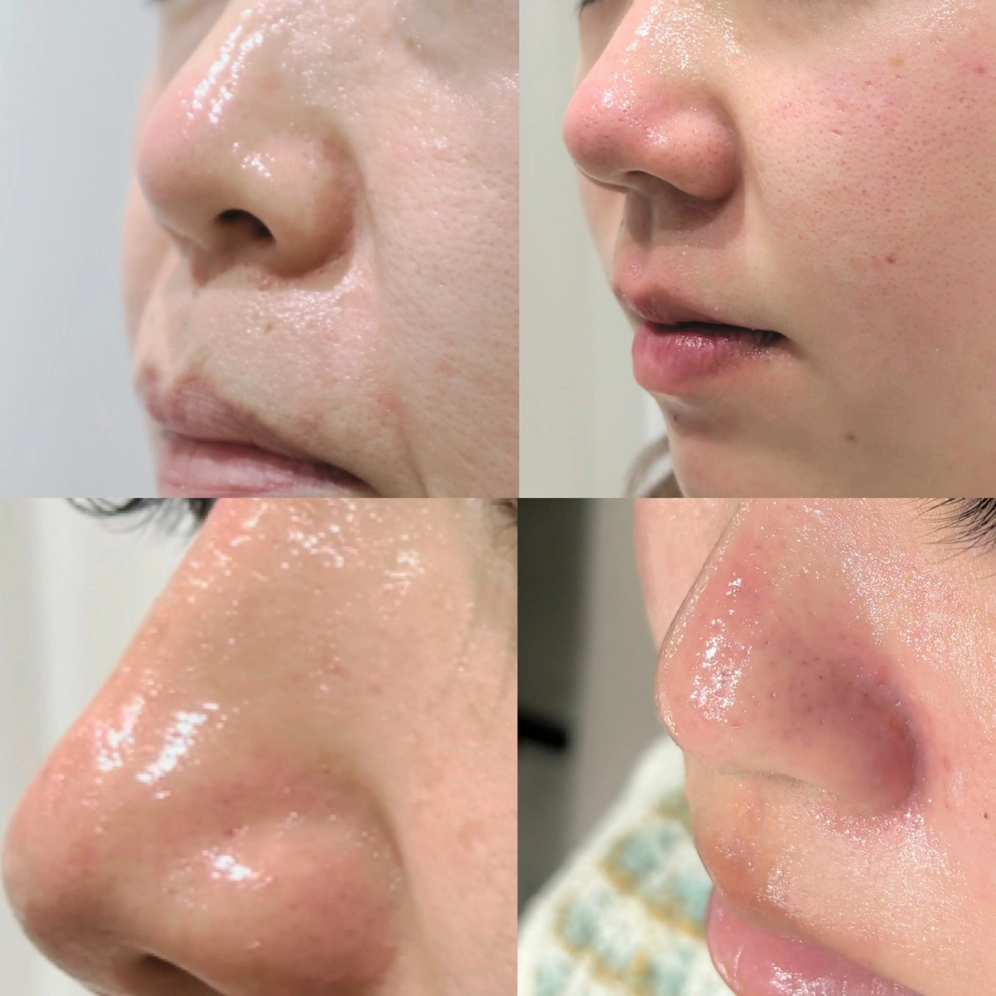 毛穴に特化したサロン MYFAIRLADYのエステ・リラクイメージ