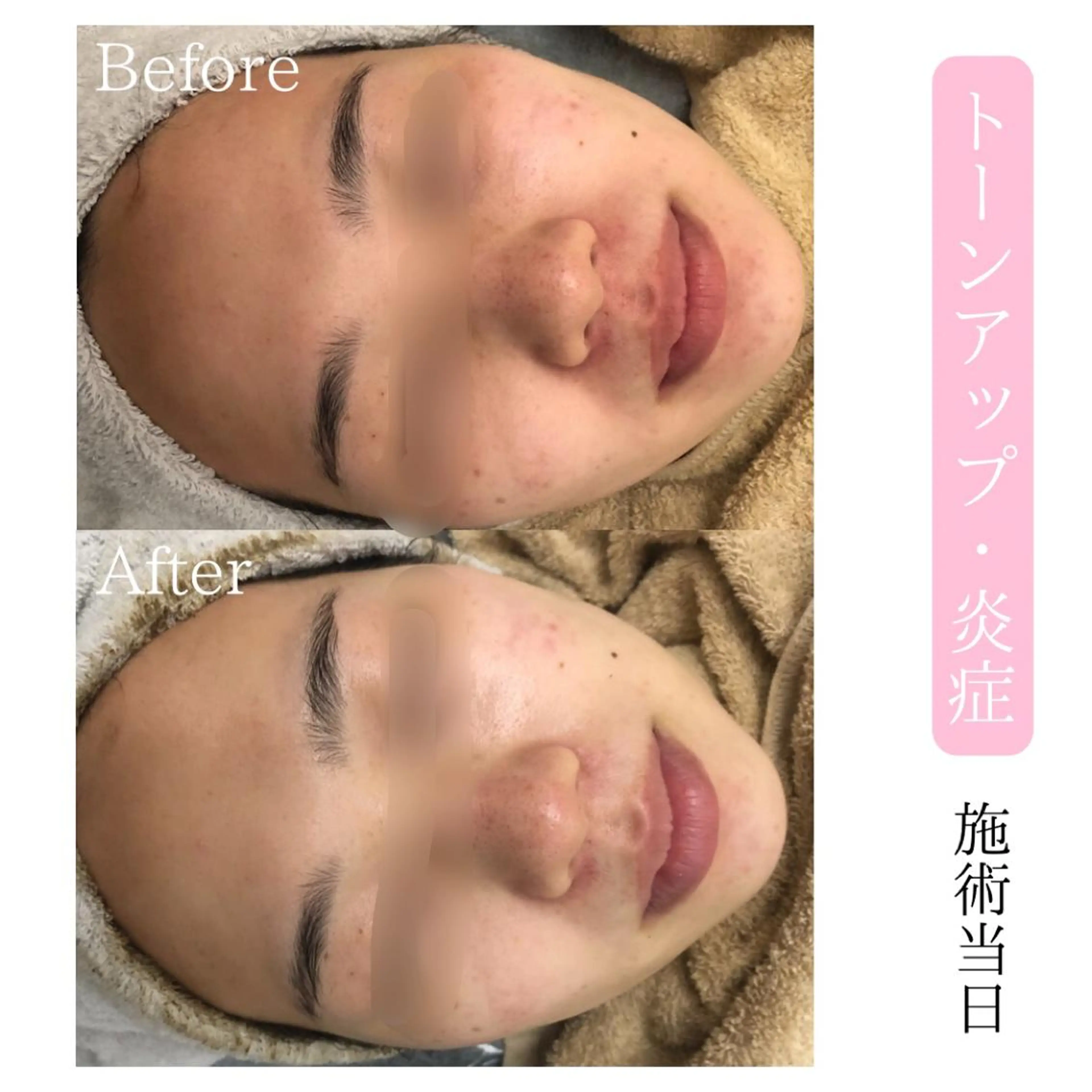 エステ BestBelleꕤ 大阪福島/肌質改善のエステ・リラクイメージ