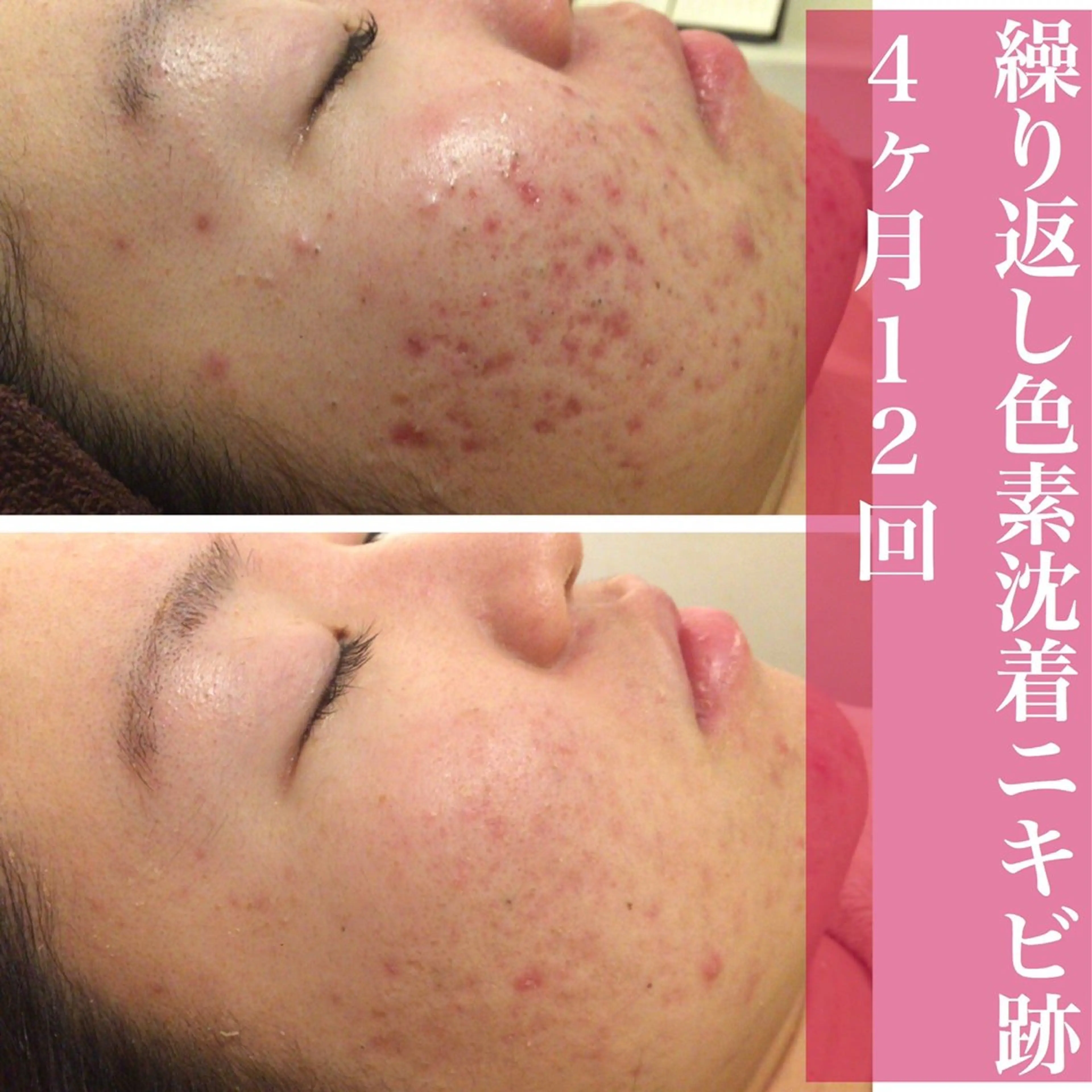 エステ リラク ニキビ・肌質改善専門 ♡人生が変わるサロンのエステ・リラクイメージ