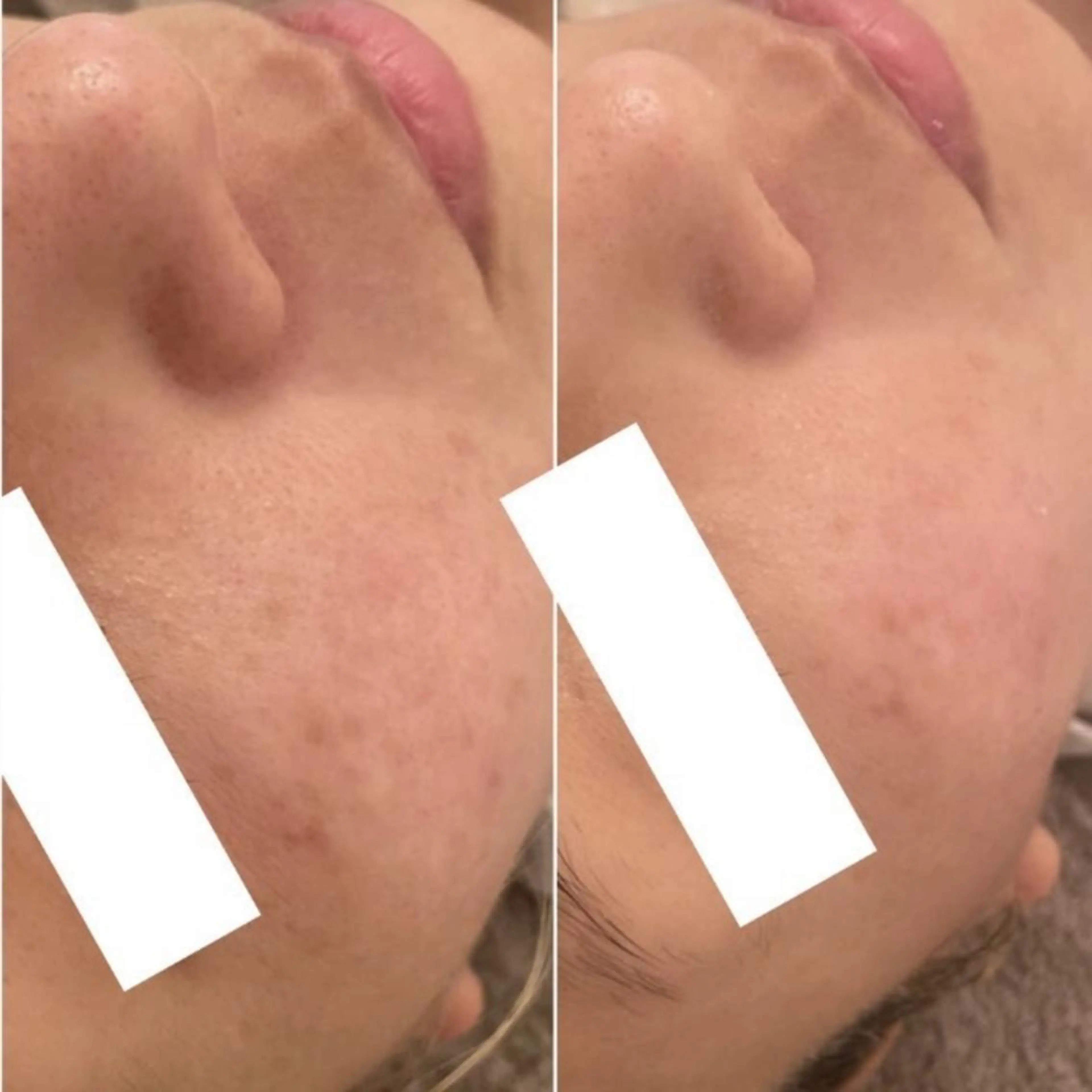 ✨美肌水光✨ アトリエリュバンのエステ・リラクイメージ