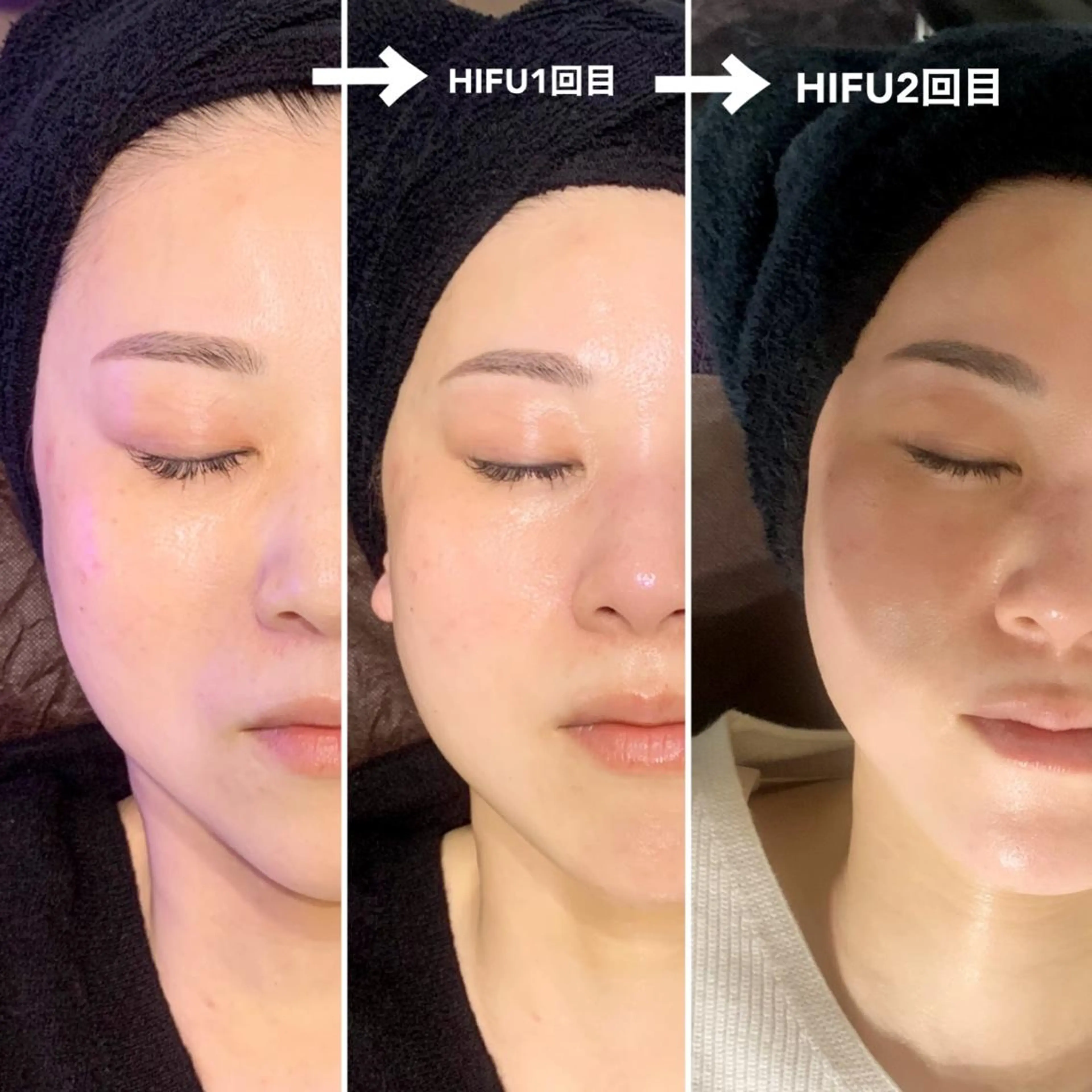 SESUNNY セサニー SEIRAのマツエク・マツパデザイン