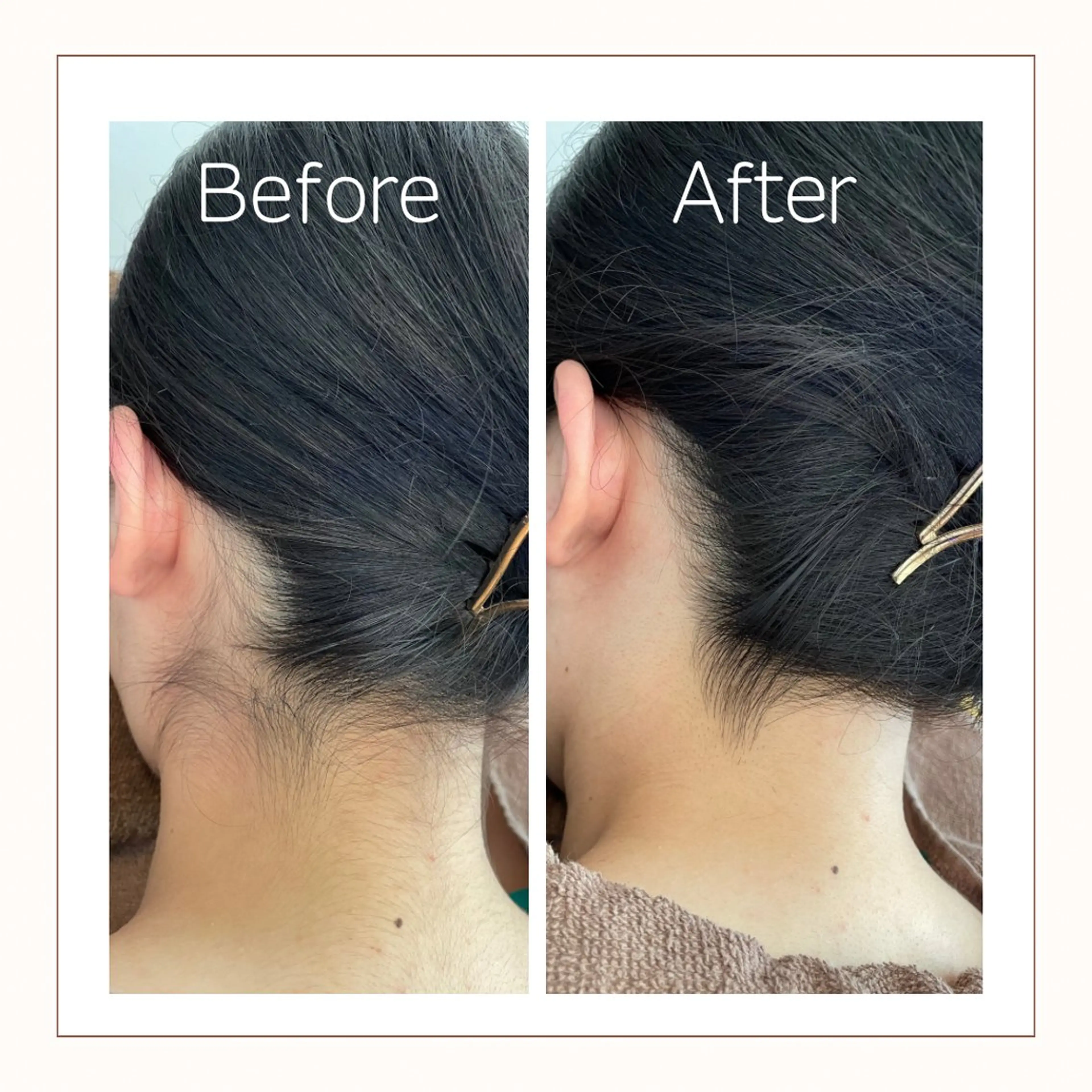 脱毛 Reid-月詠-所属・Reid -月詠-のエステ・リラクイメージ