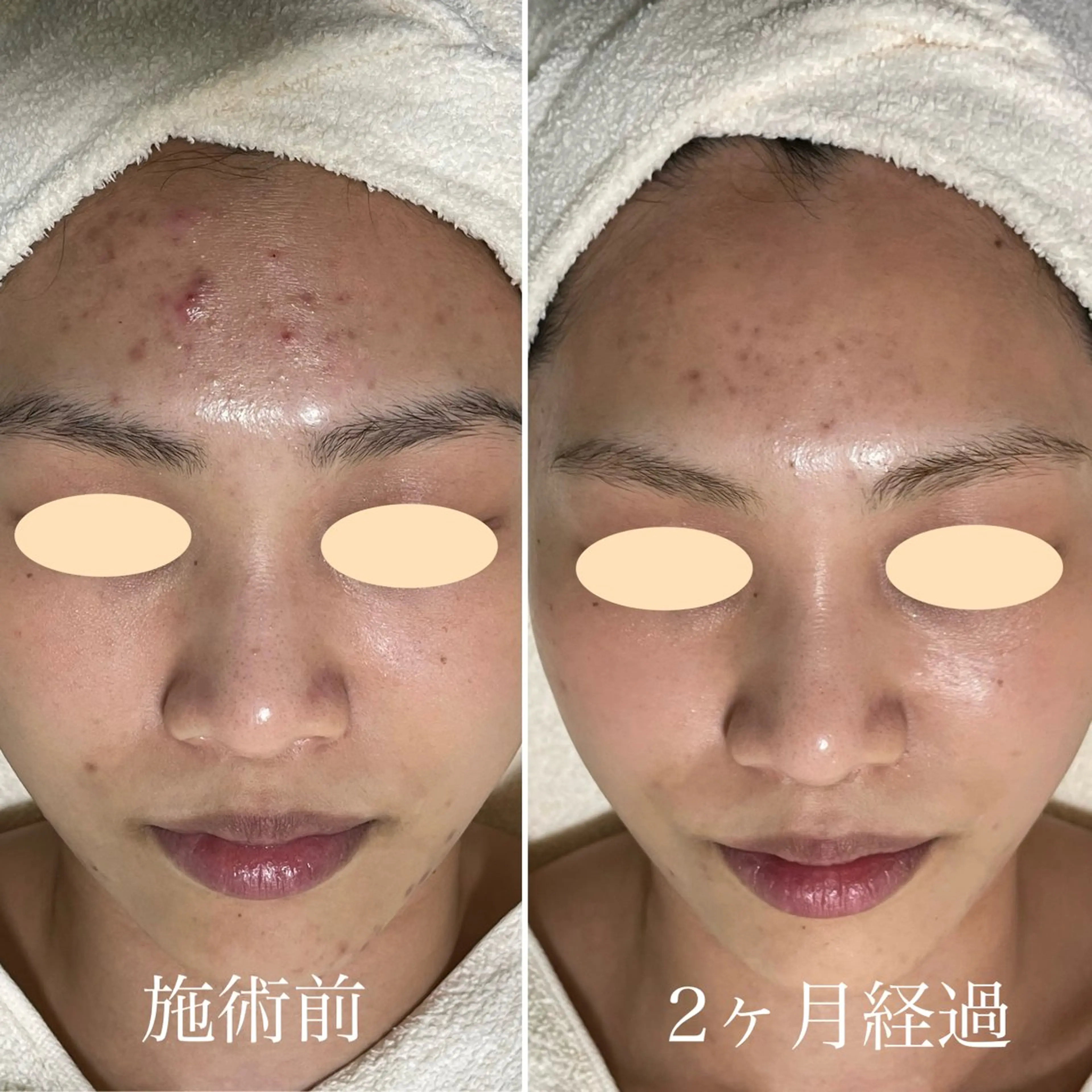 エステ シェノン所属・ニキビ・毛穴・ フェイシャル専門店のその他イメージ