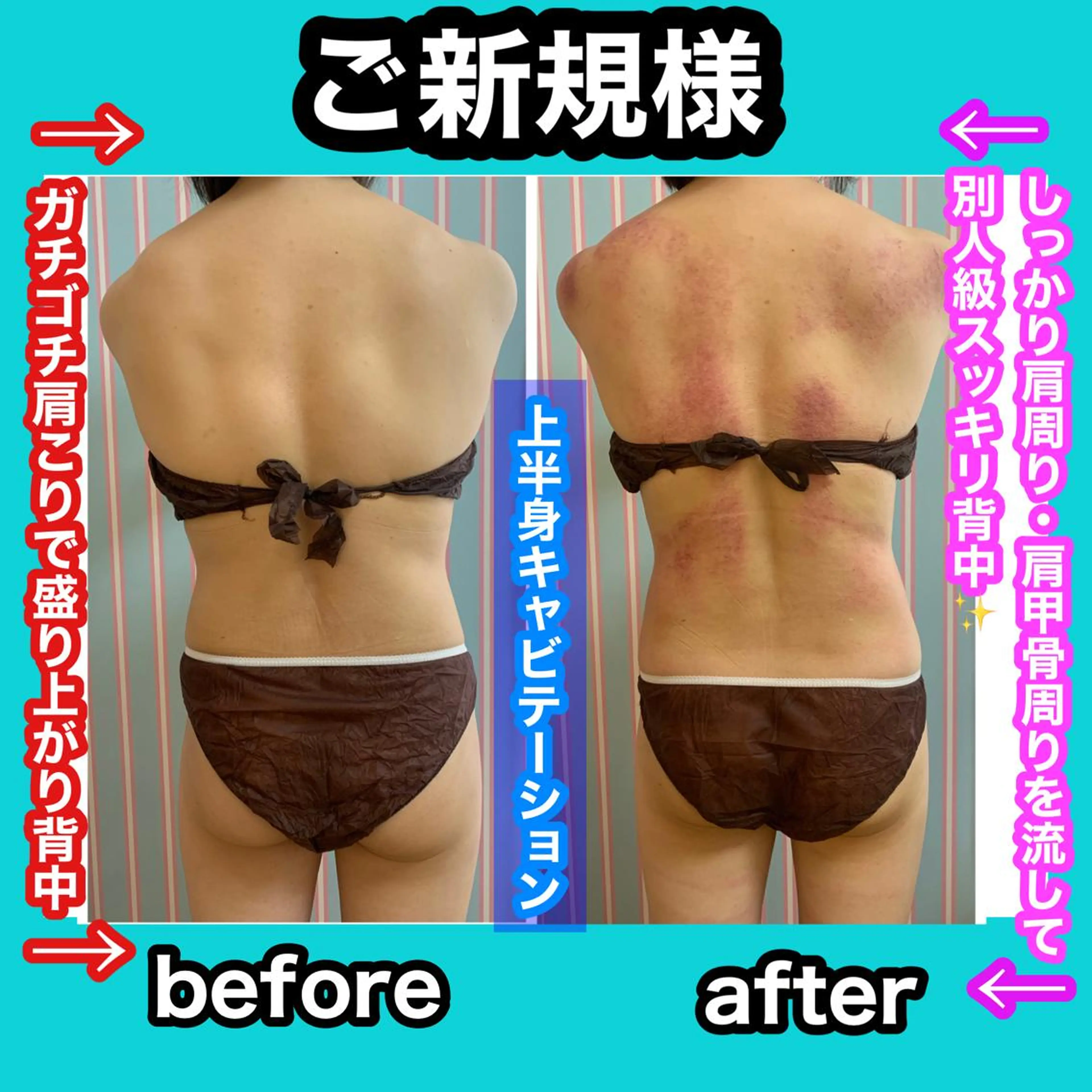 エステ リラク 痩身/脱毛/ネイル HARUKAのエステ・リラクイメージ