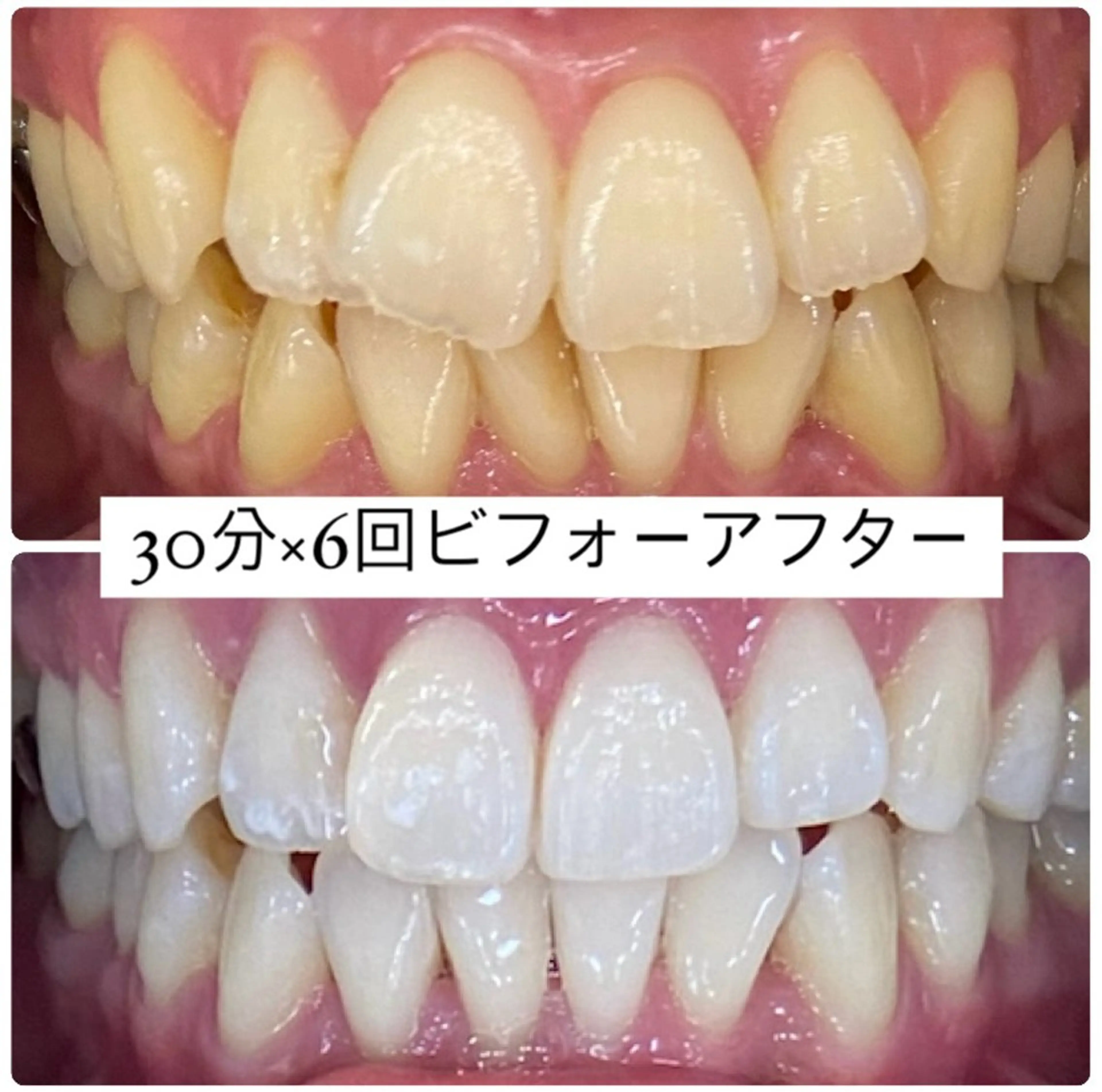 PLATINUM Beauty 横浜店所属・ホワイトニングルーム 横浜店のその他イメージ