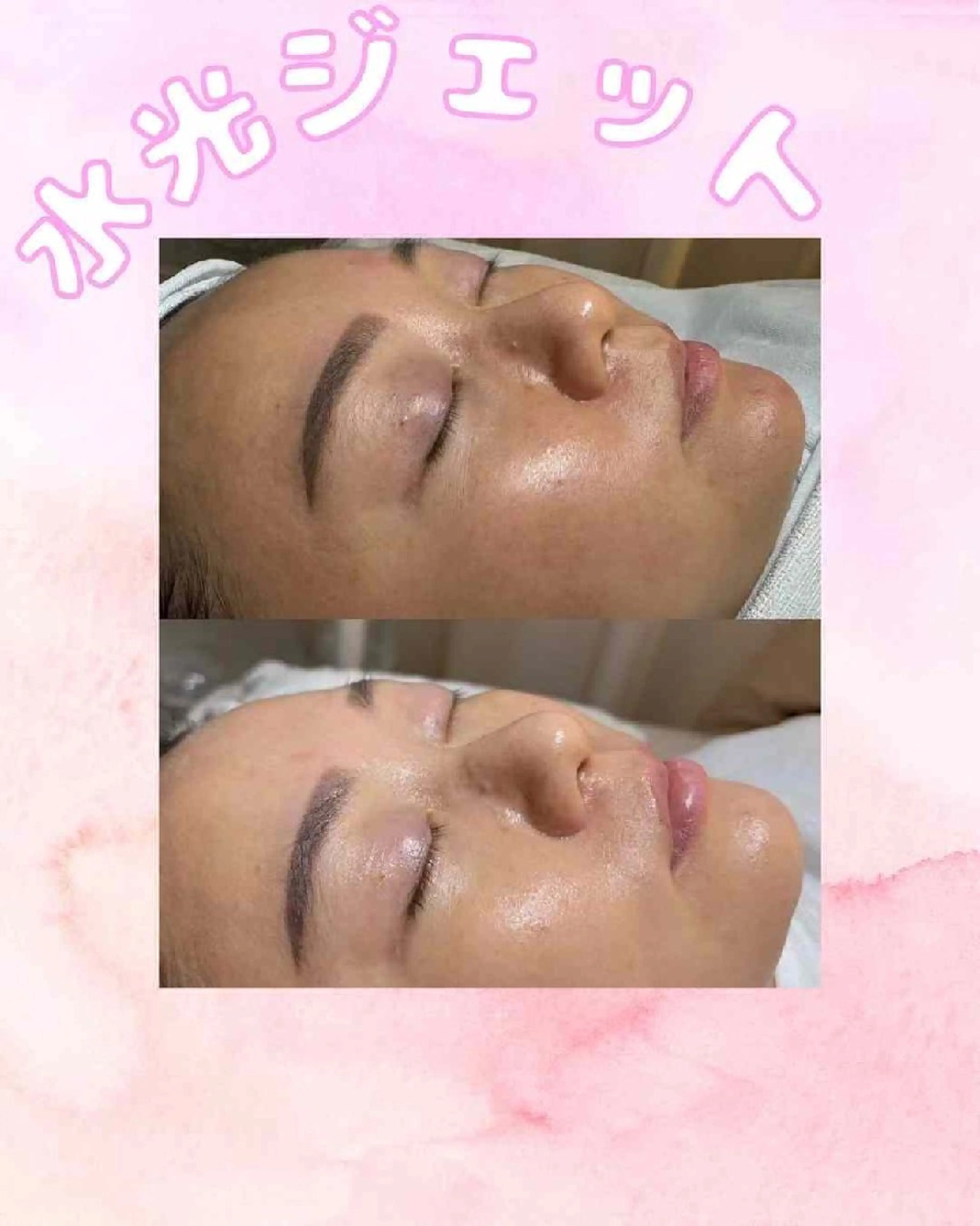 アイブロウ 眉毛ワックス脱毛 aliaハイフ&水光ジェットサロン所属・aliaハーブ水光店 エステティシャン募集のエステ・リラクイメージ