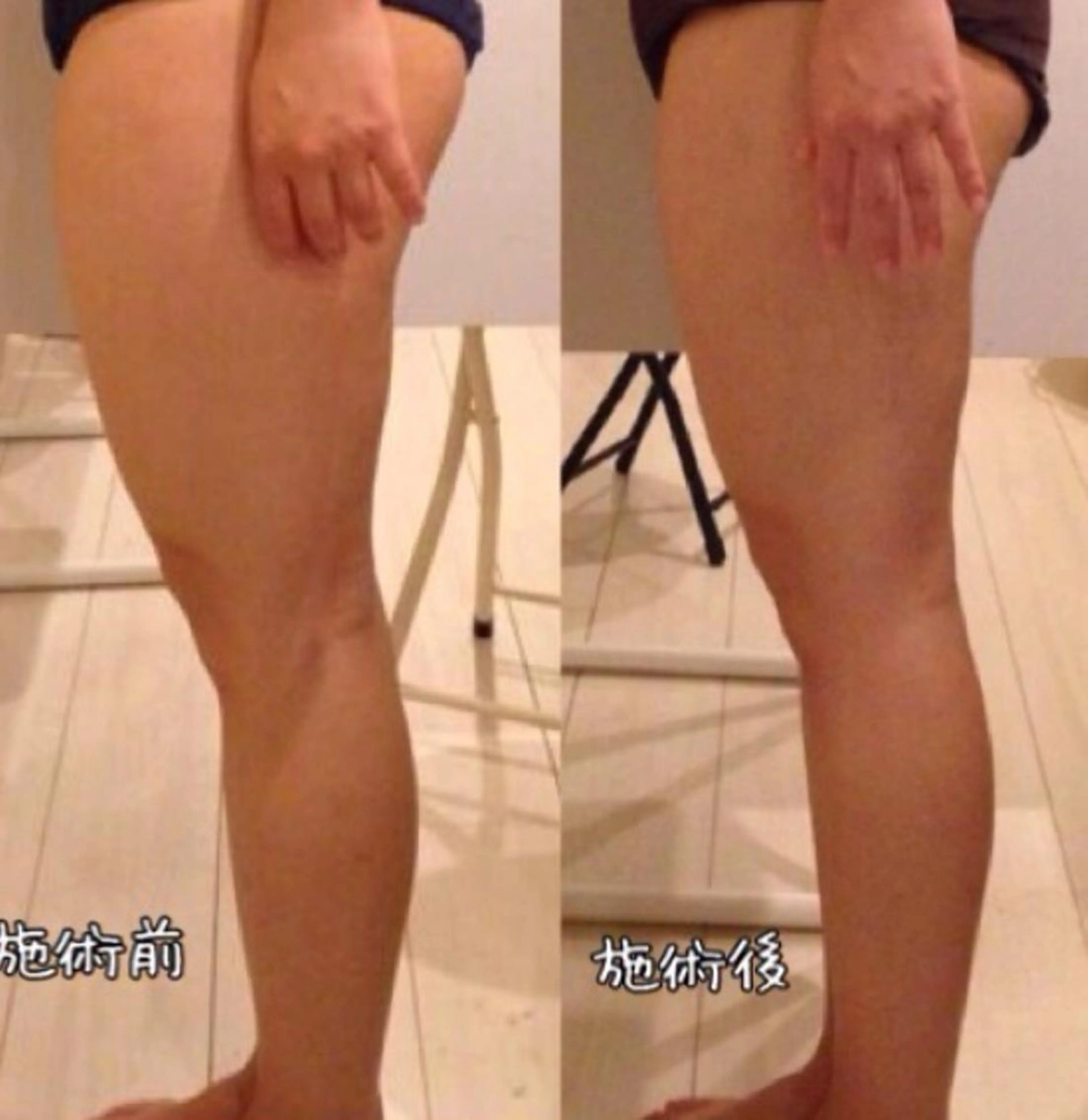 💓スラッと美脚,小尻,むくみや冷えに💓【痩身深部アロマリンパ美脚集中40分】の写真