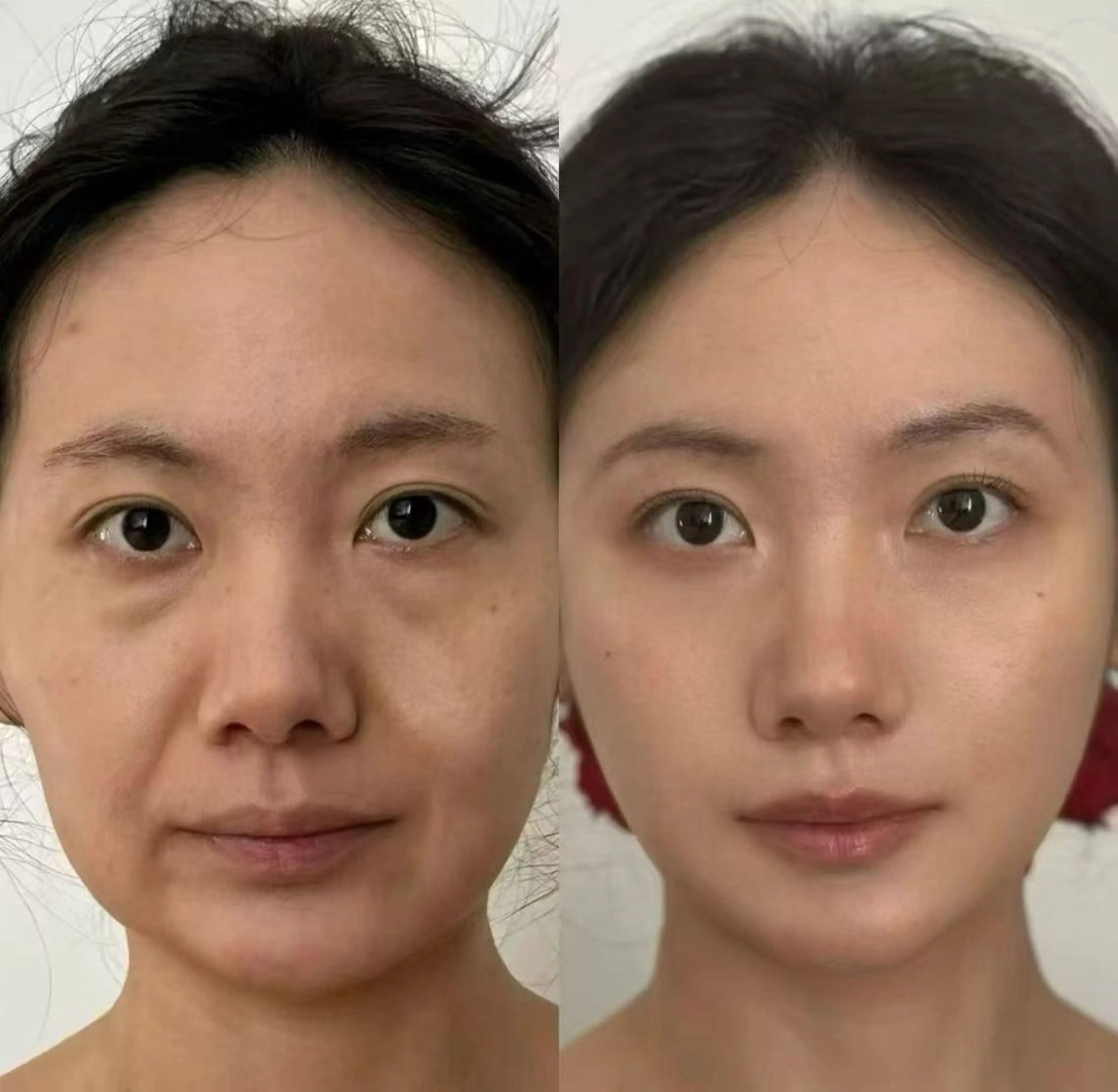 マツエク・マツパ エステ aliaハイフ&水光ジェットサロン所属・aliaハーブ水光店 エステティシャン募集のエステ・リラクイメージ