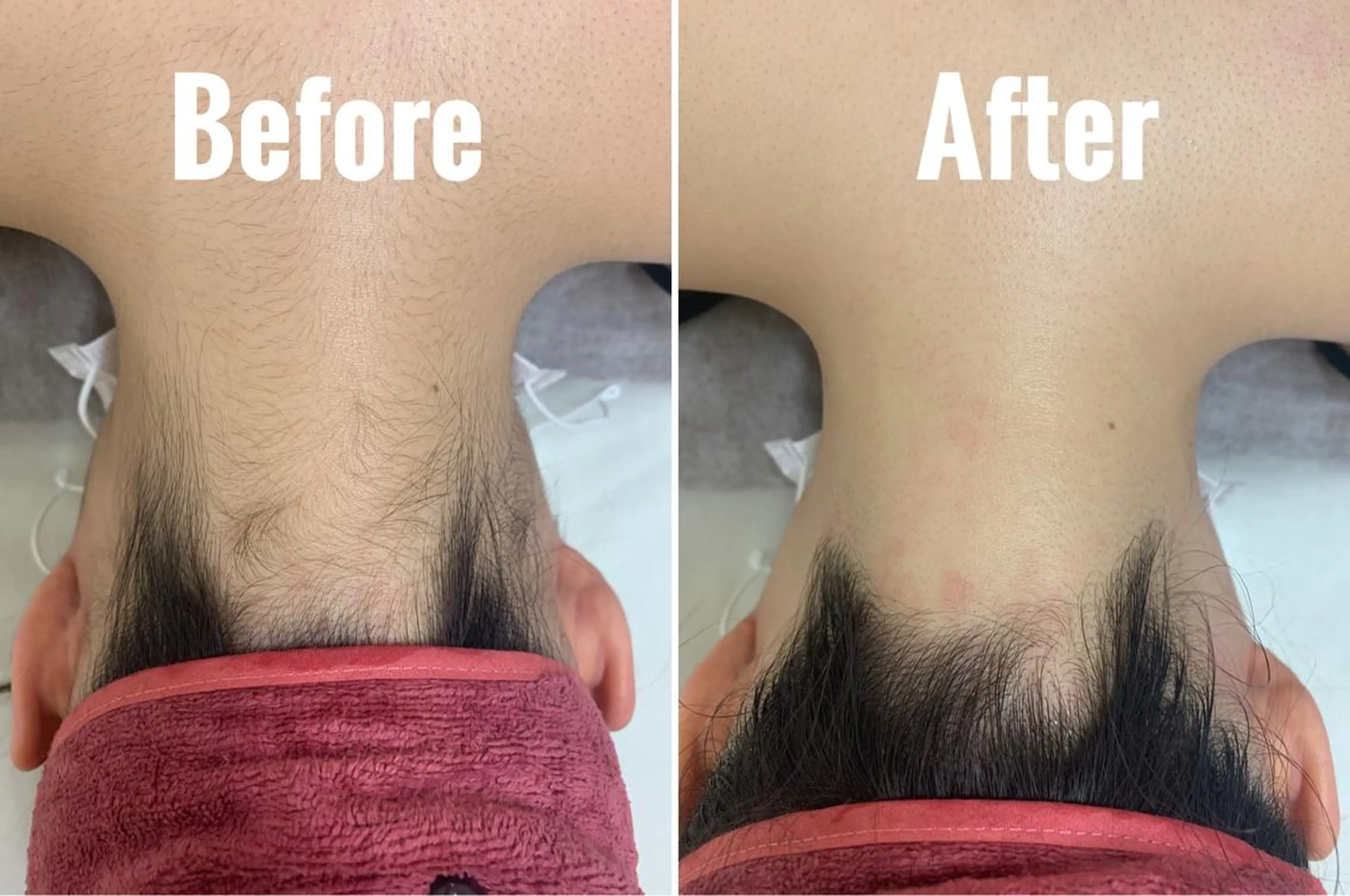 バストケア RAYVIS梅田店Nのエステ・リラクイメージ