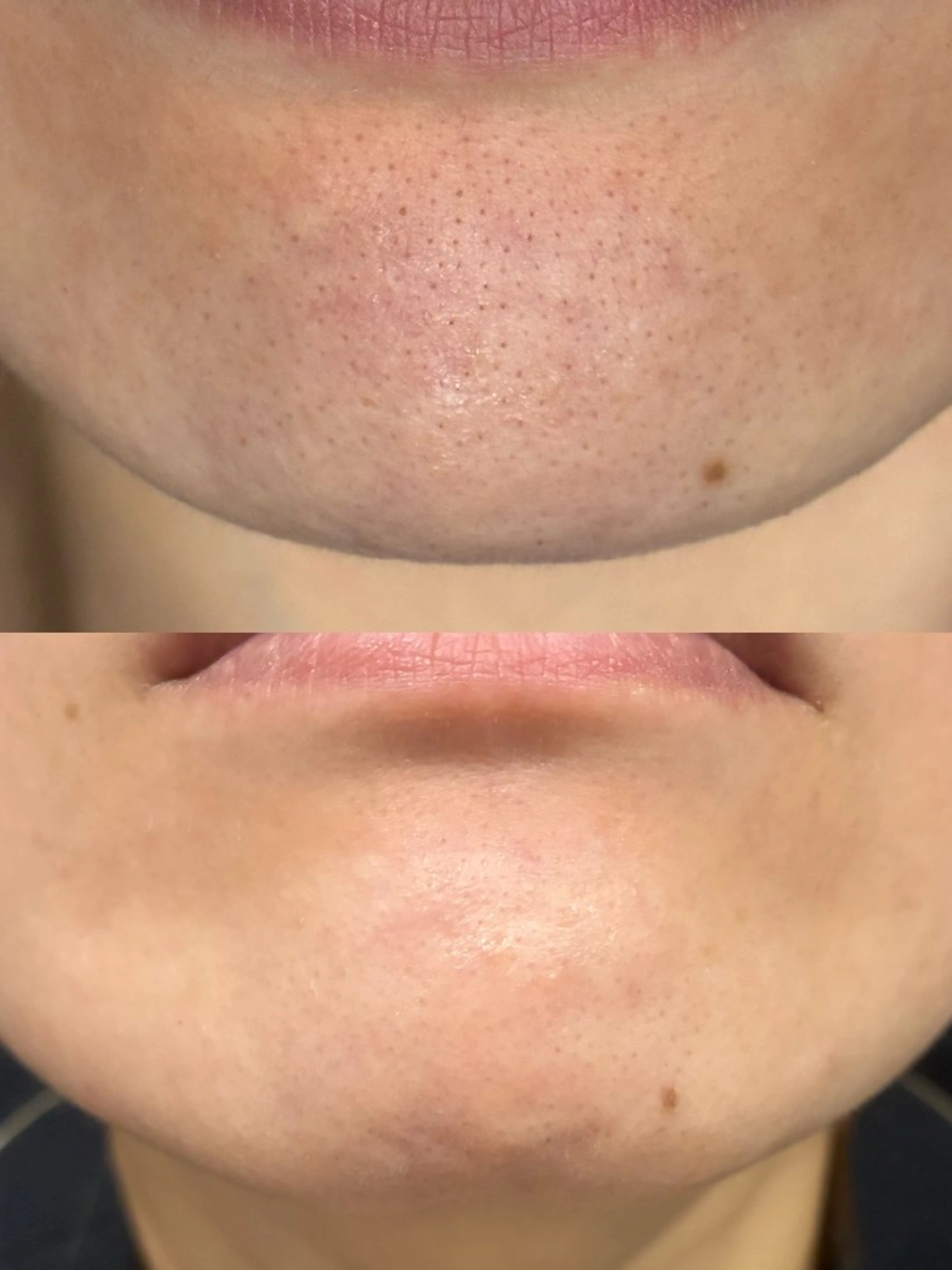 エステ DahliaBeauty ダリアビューティー所属・DahliaBeau tyフェイシャル中村のエステ・リラクイメージ