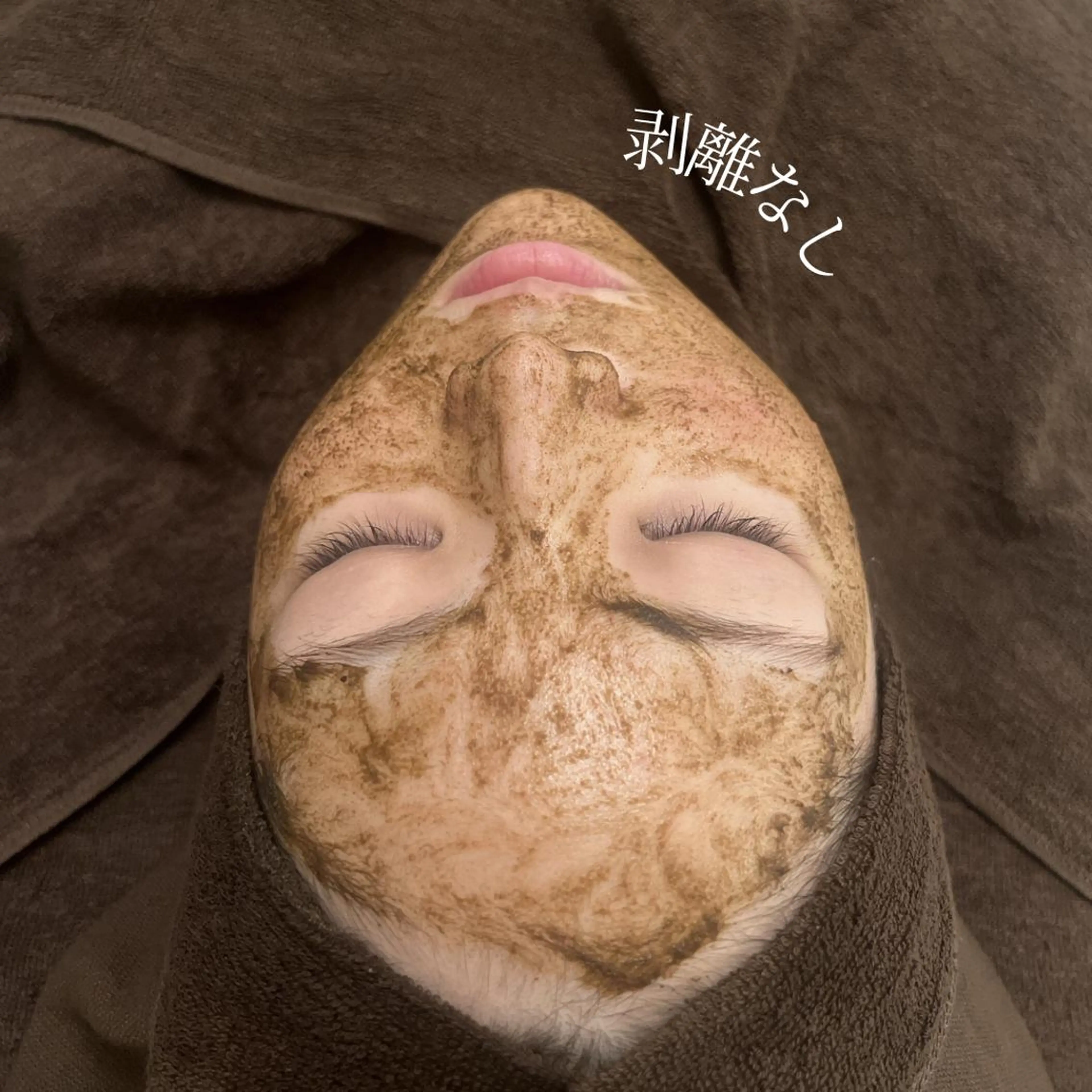 🧡ハーブピーリング🍃🌿ニキビ、毛穴、皮脂分泌、乾燥、敏感肌の写真