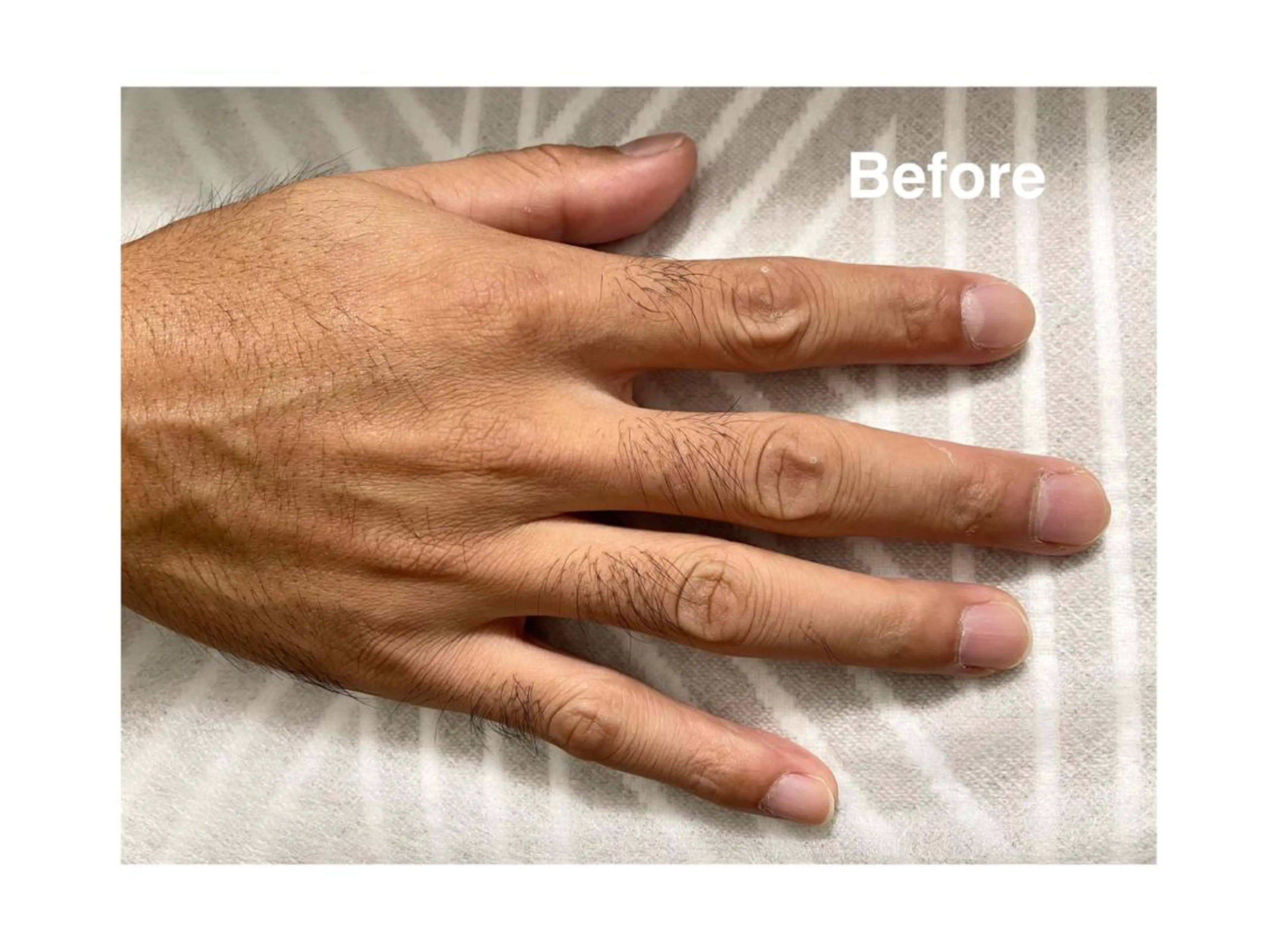 地上のトレチカ sugaringのエステ・リラクイメージ