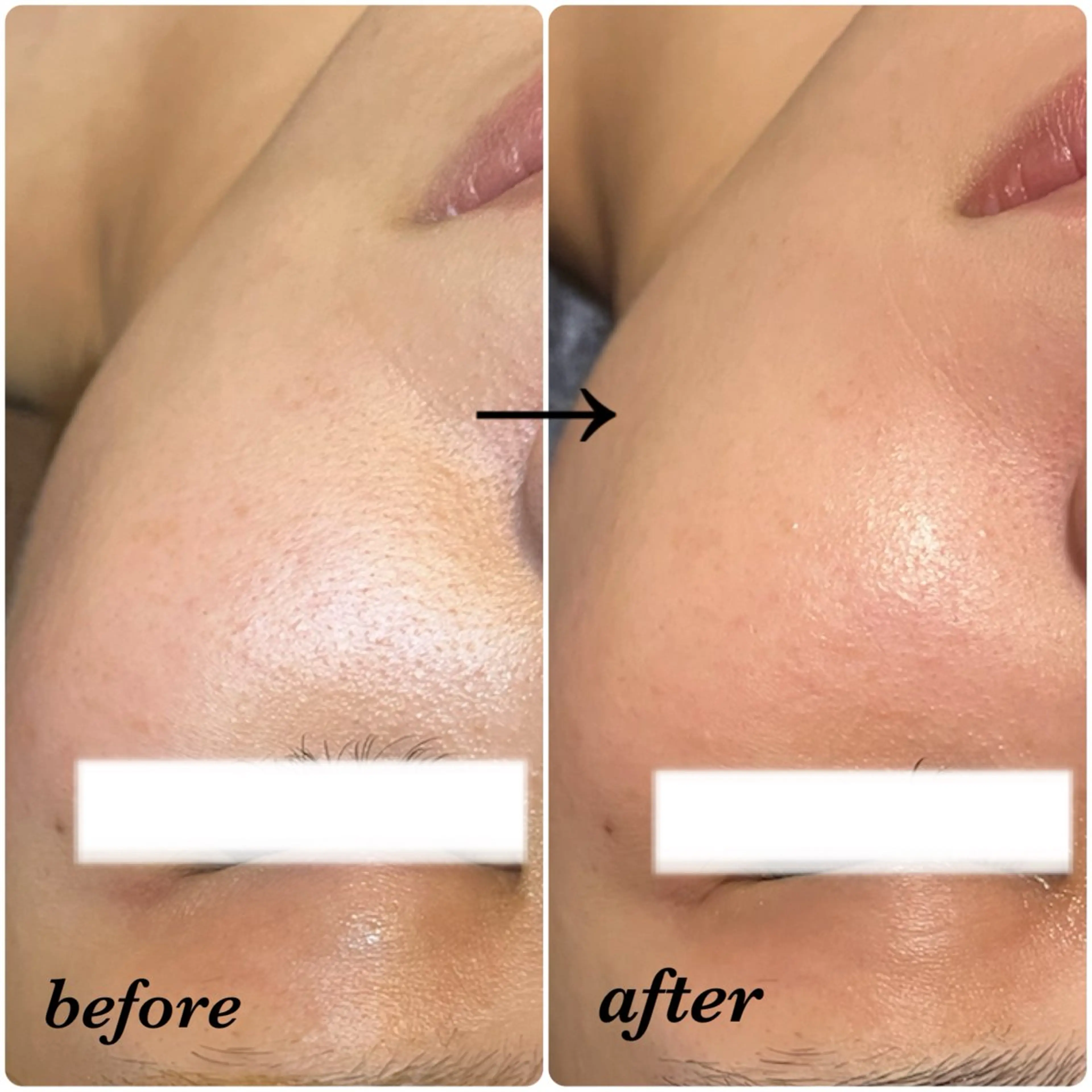 salon akua nail＆リラクのネイルデザイン