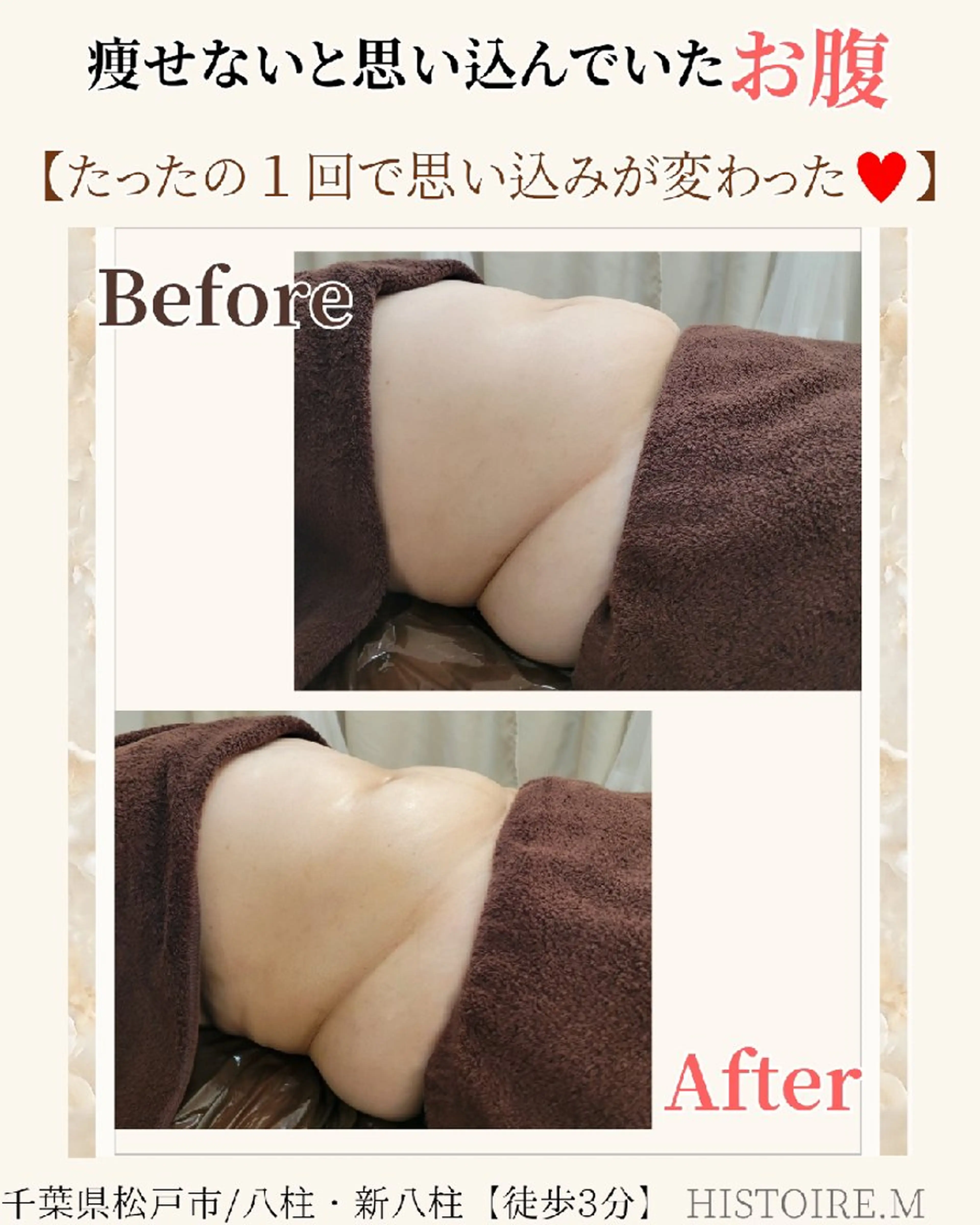 エステ リラク HISTOIRE.M イストアールエム所属・ダイエット/体質改善 /筋膜リリース専門店のエステ・リラクイメージ