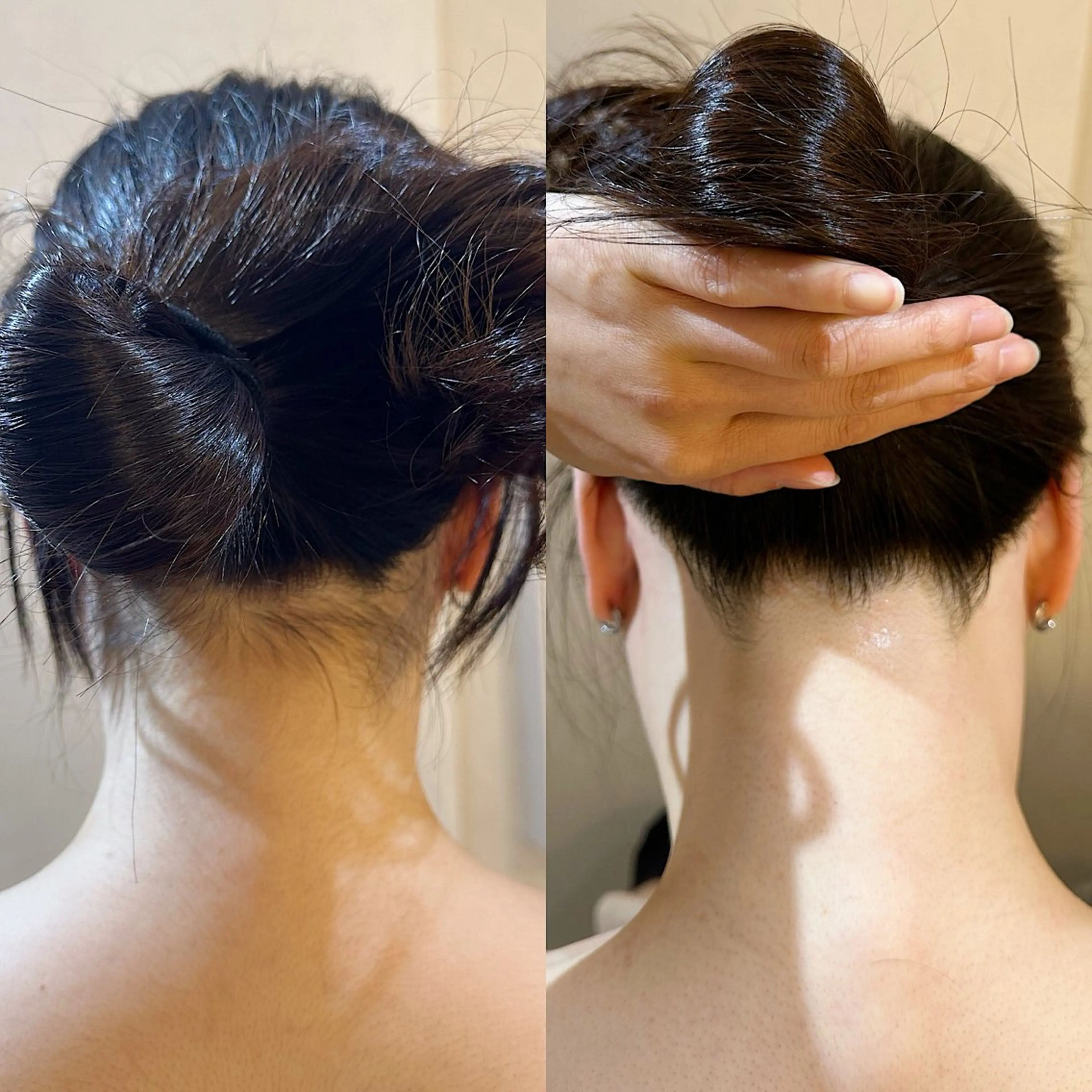 脱毛 うなじ脱毛/美肌脱毛 LABELのエステ・リラクイメージ