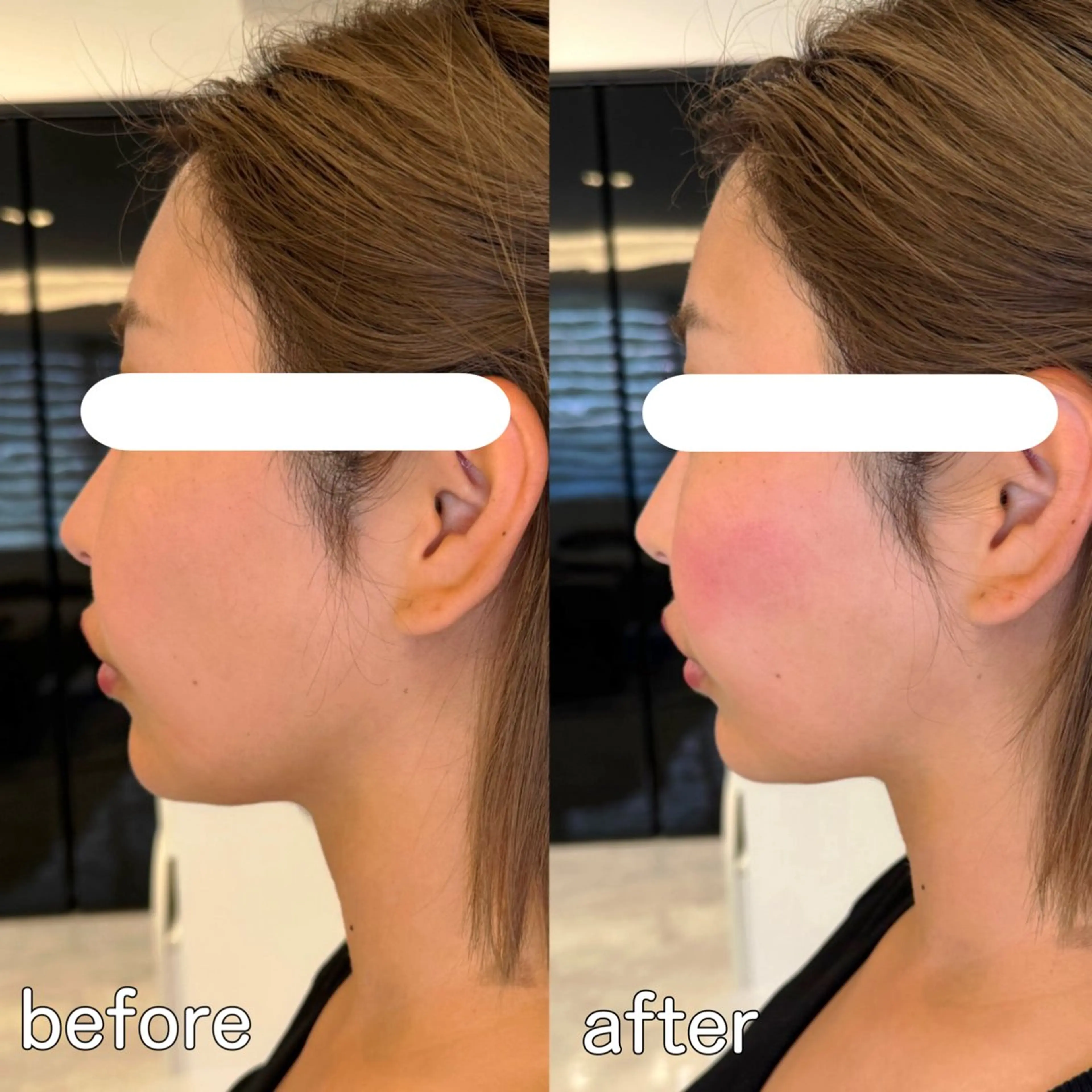 小顔矯正&美容整体 整え屋REDオーナーのエステ・リラクイメージ