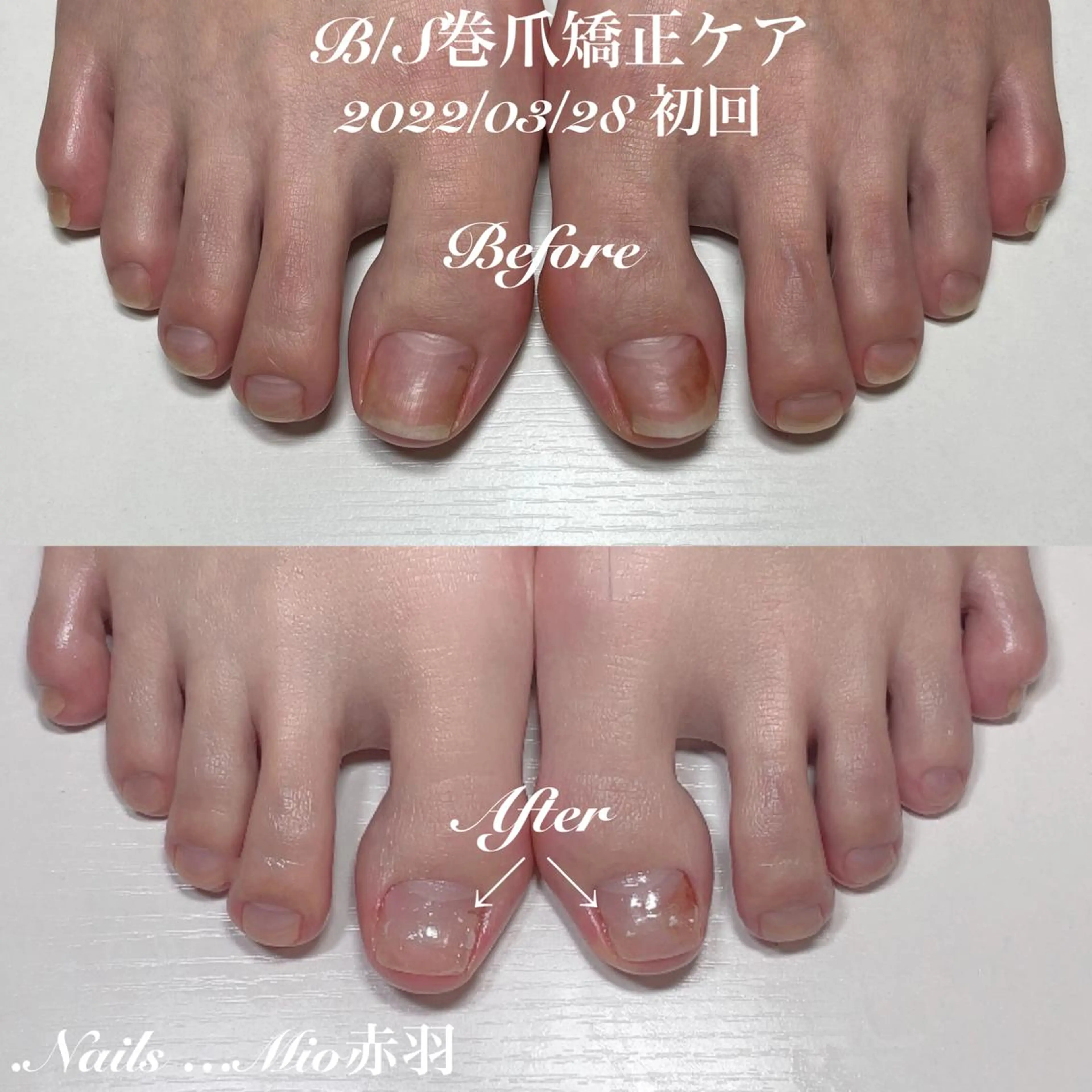 ネイル フットネイル .Nails Mio 赤羽西ネイルサロンのネイルデザイン