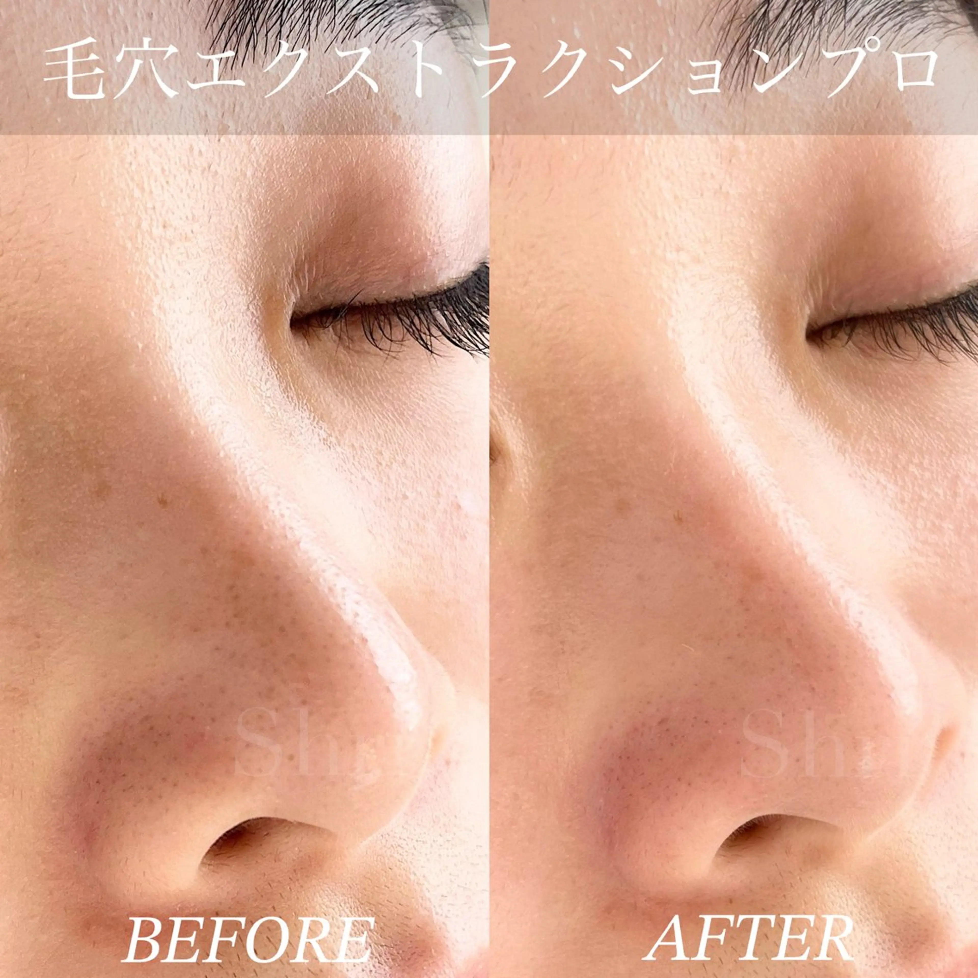 エステ salon Shri所属・salon Shriのマツエク・マツパデザイン