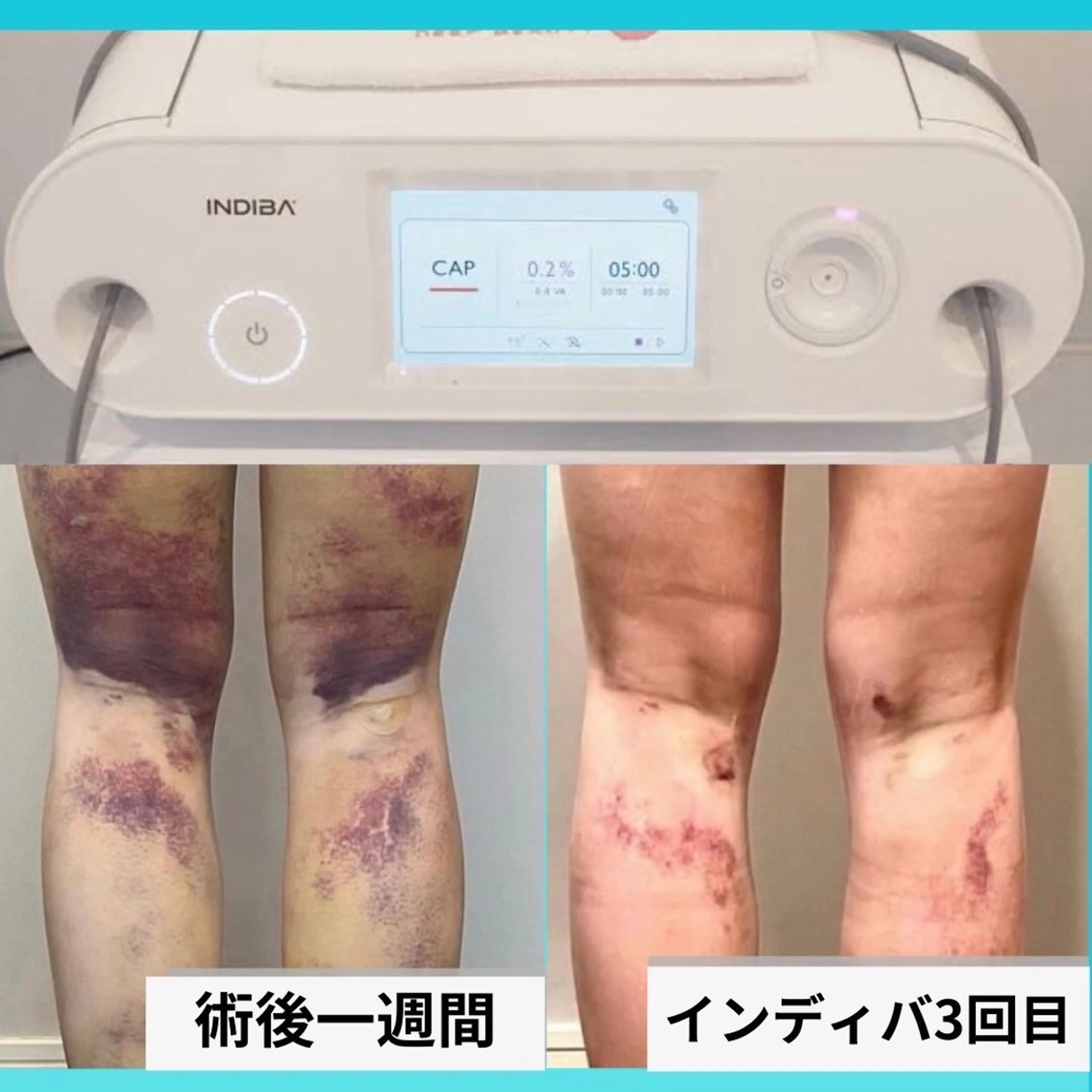 エステ リラク ルルアス GINZAのエステ・リラクイメージ