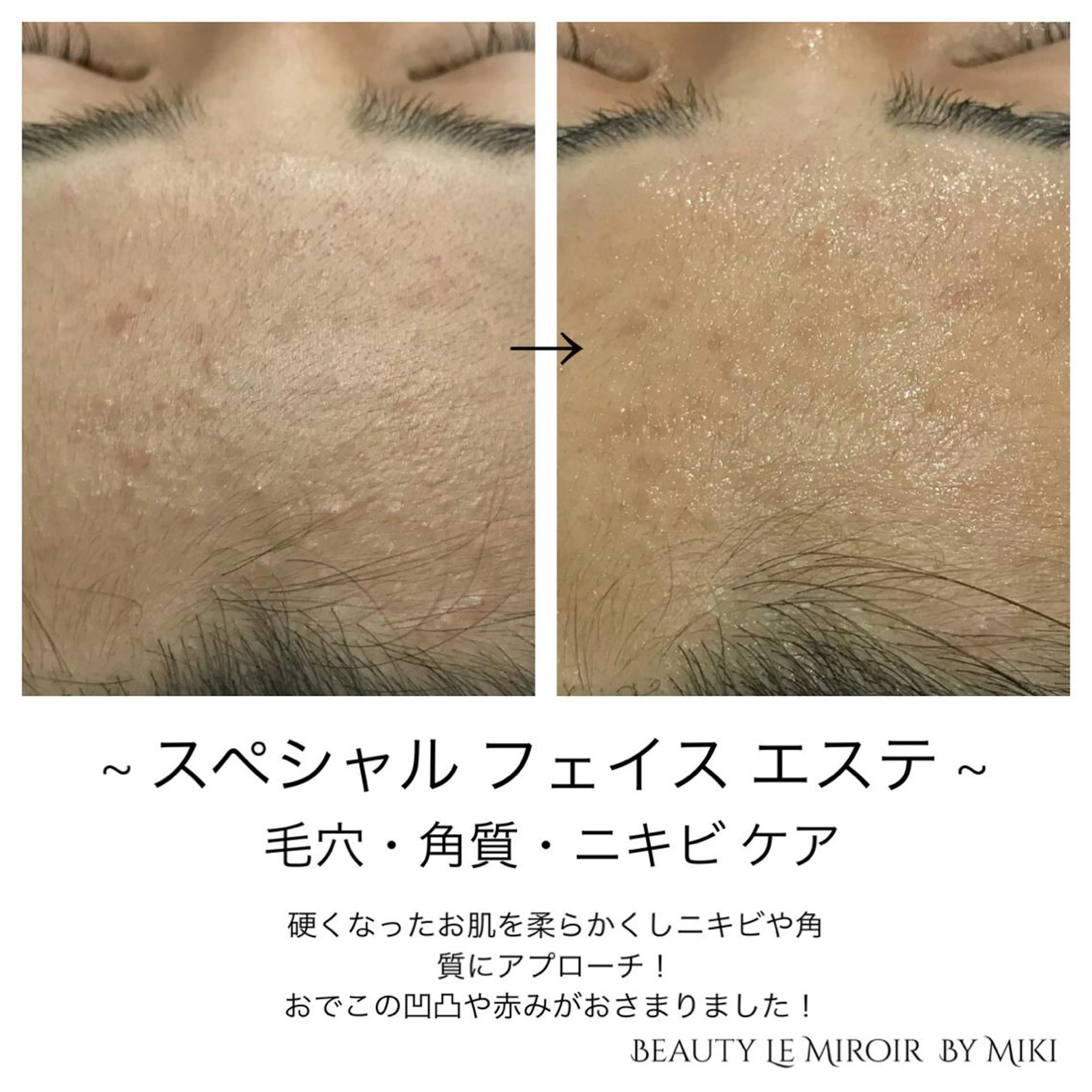 ビューティー ミロワールのエステ・リラクイメージ