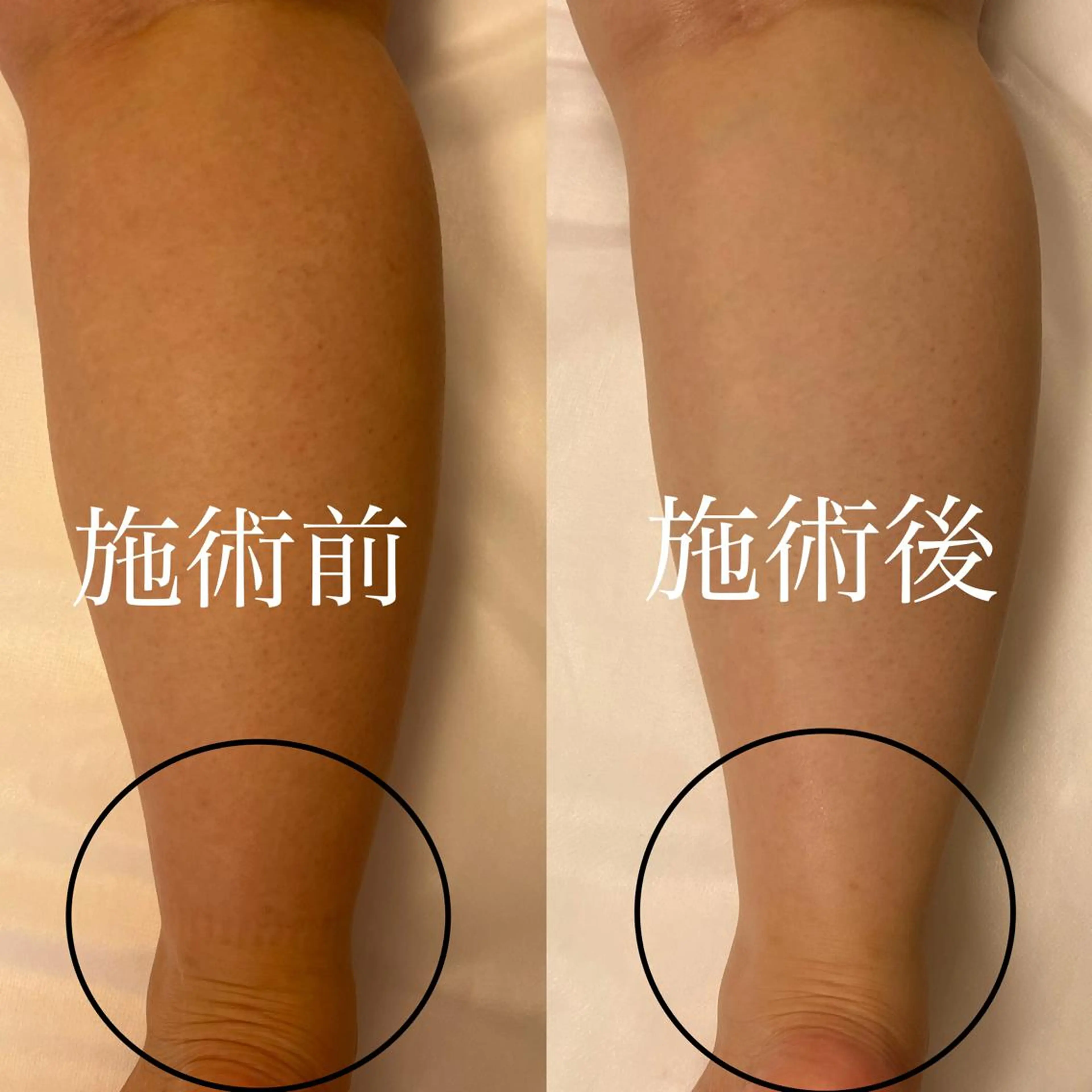 WOM SALON所属・MIKU【美容整形ダ ウンタイムケア銀座】のエステ・リラクイメージ