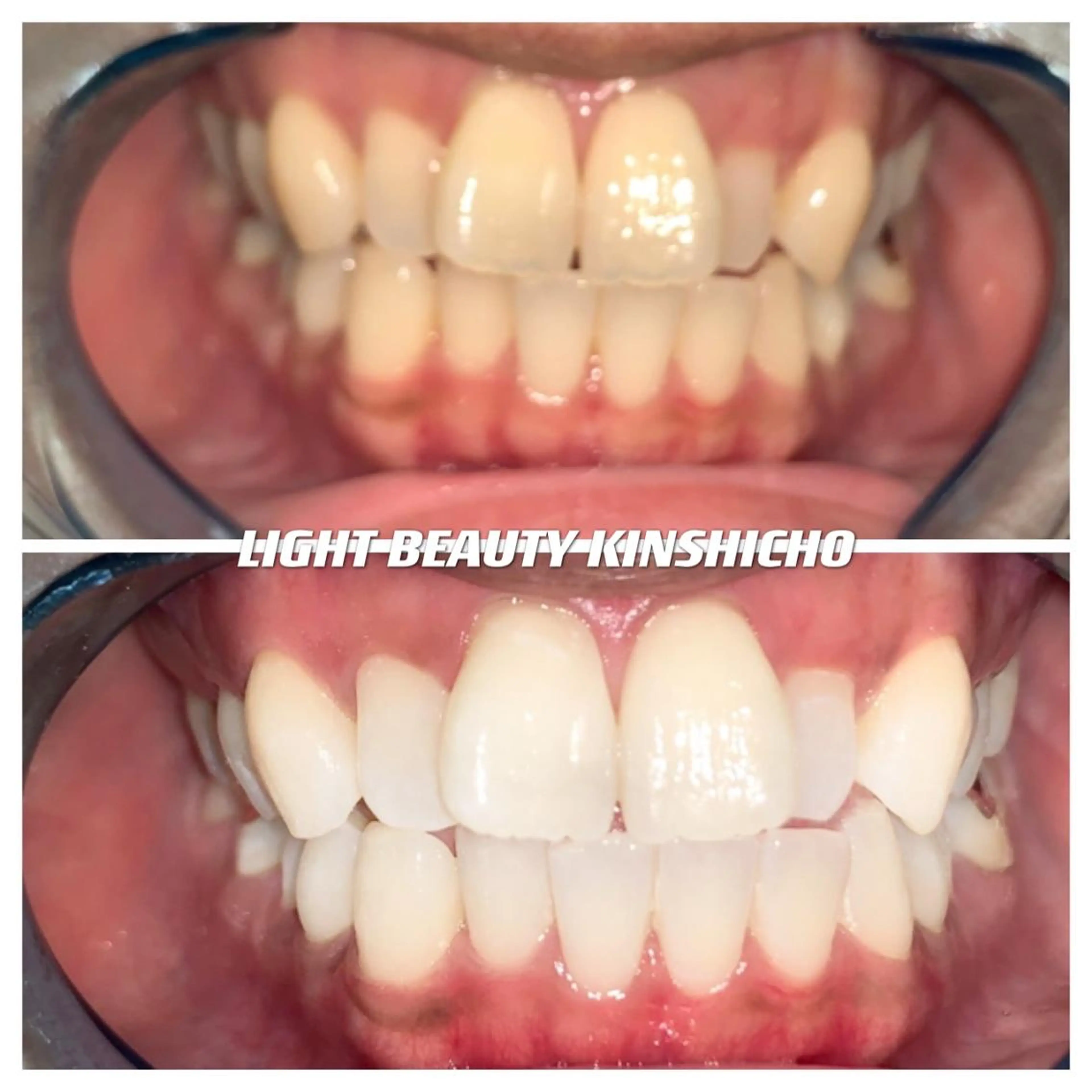 ライトビューティー 錦糸町店のエステ・リラクイメージ