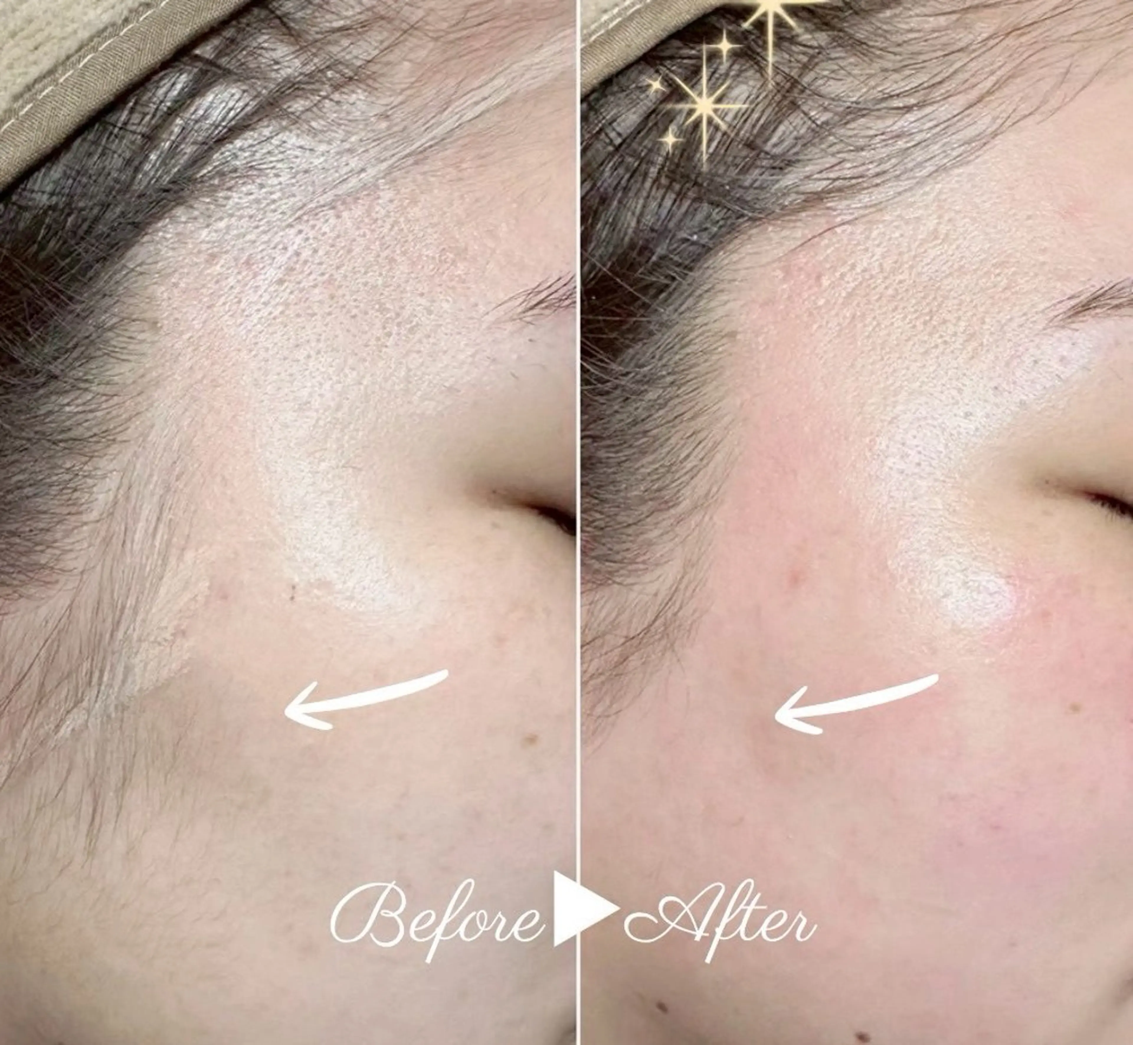 脱毛 salon de cocoa所属・MI YAの眉毛・アイブロウイメージ